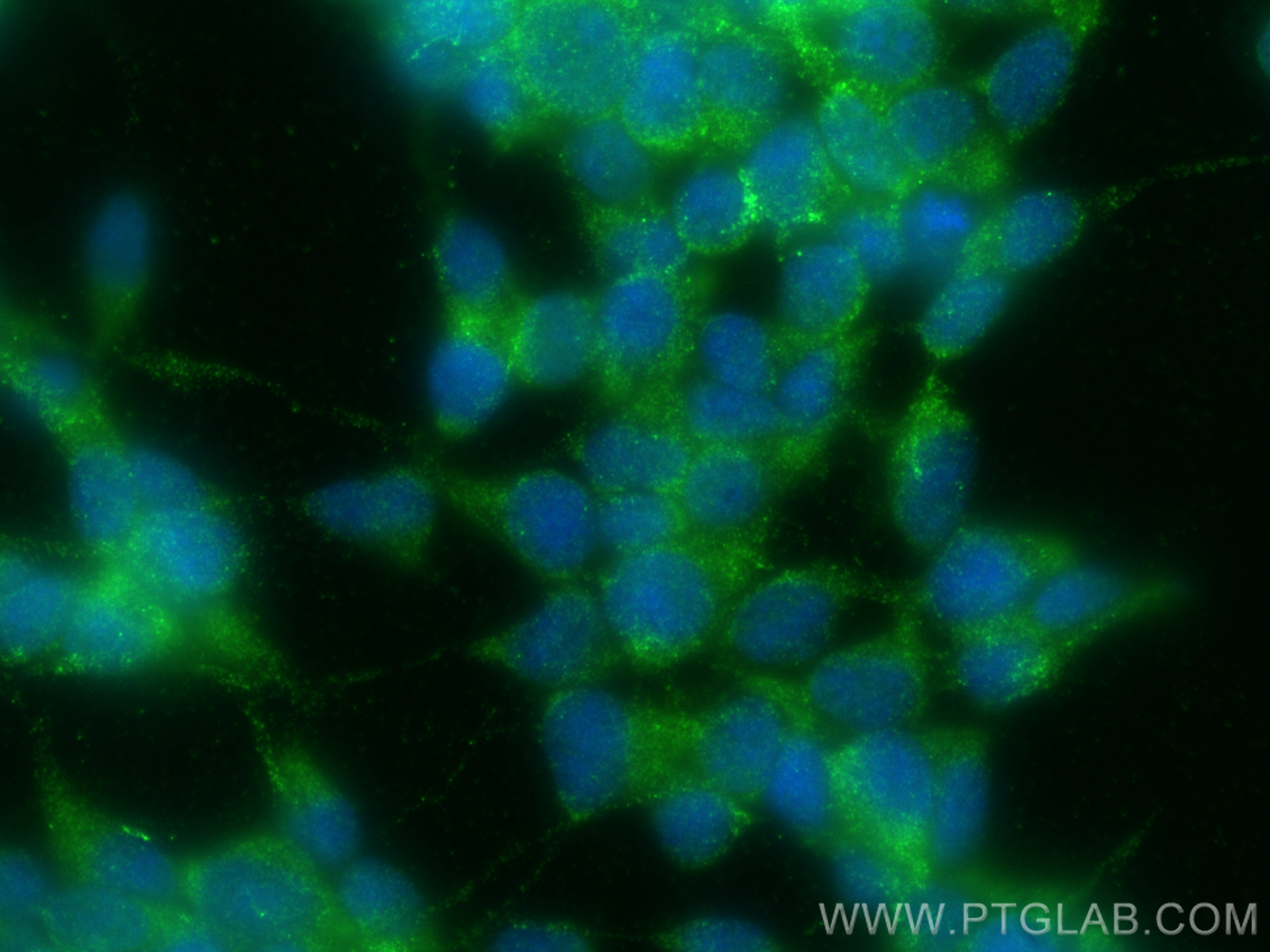 Immunofluorescence (IF) / fluorescent staining of SH-SY5Y cells using RPH3A Polyclonal antibody (11396-1-AP)