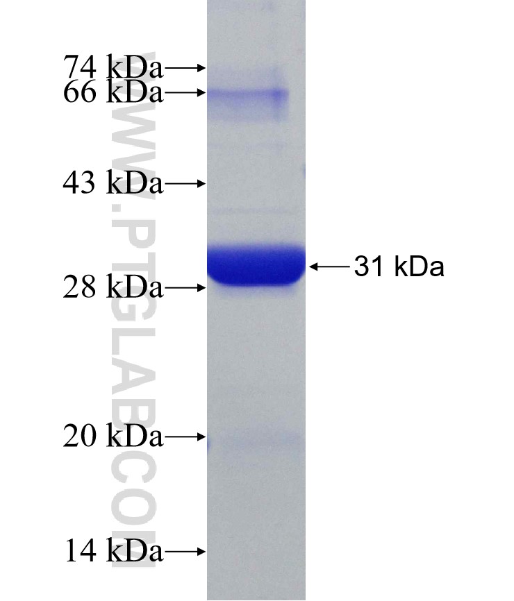 RPL10A fusion protein Ag30526 SDS-PAGE