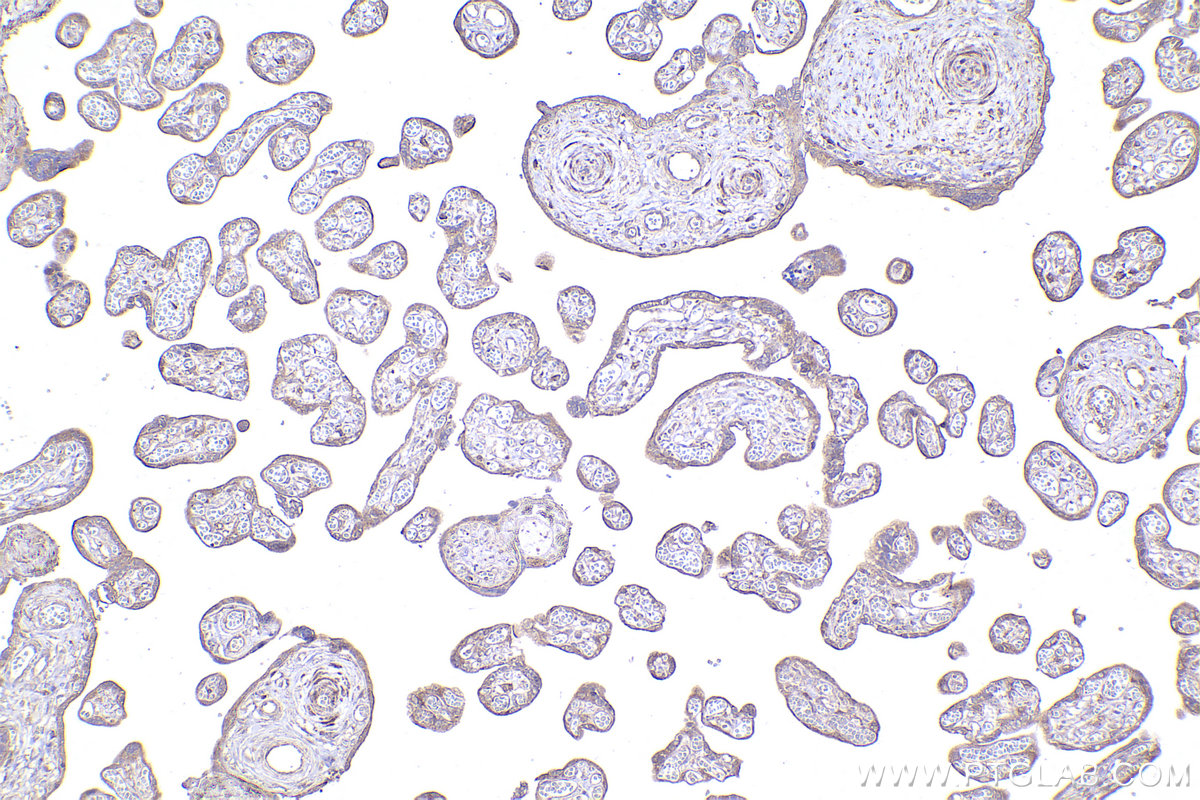 Immunohistochemistry (IHC) staining of human placenta tissue using RPL12 Polyclonal antibody (14536-1-AP)