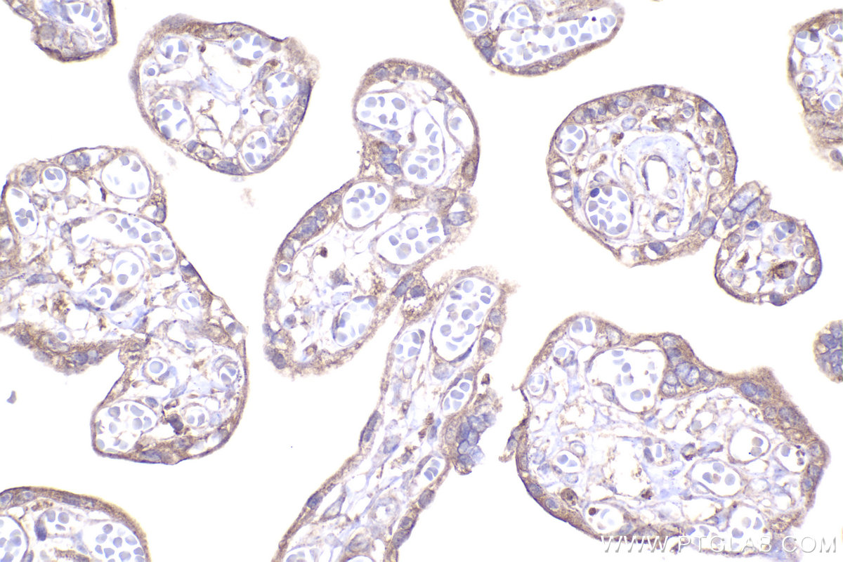 Immunohistochemistry (IHC) staining of human placenta tissue using RPL12 Polyclonal antibody (14536-1-AP)