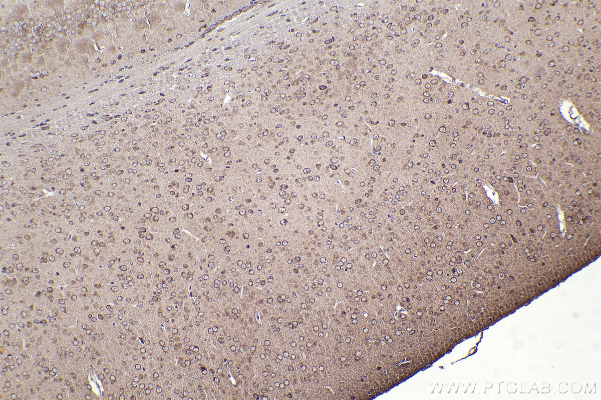 Immunohistochemistry (IHC) staining of mouse brain tissue using RPL12 Polyclonal antibody (14536-1-AP)