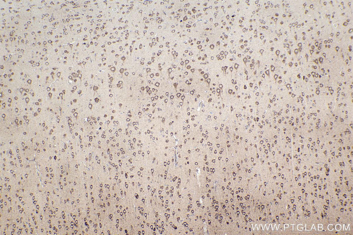 Immunohistochemistry (IHC) staining of rat brain tissue using RPL12 Polyclonal antibody (14536-1-AP)