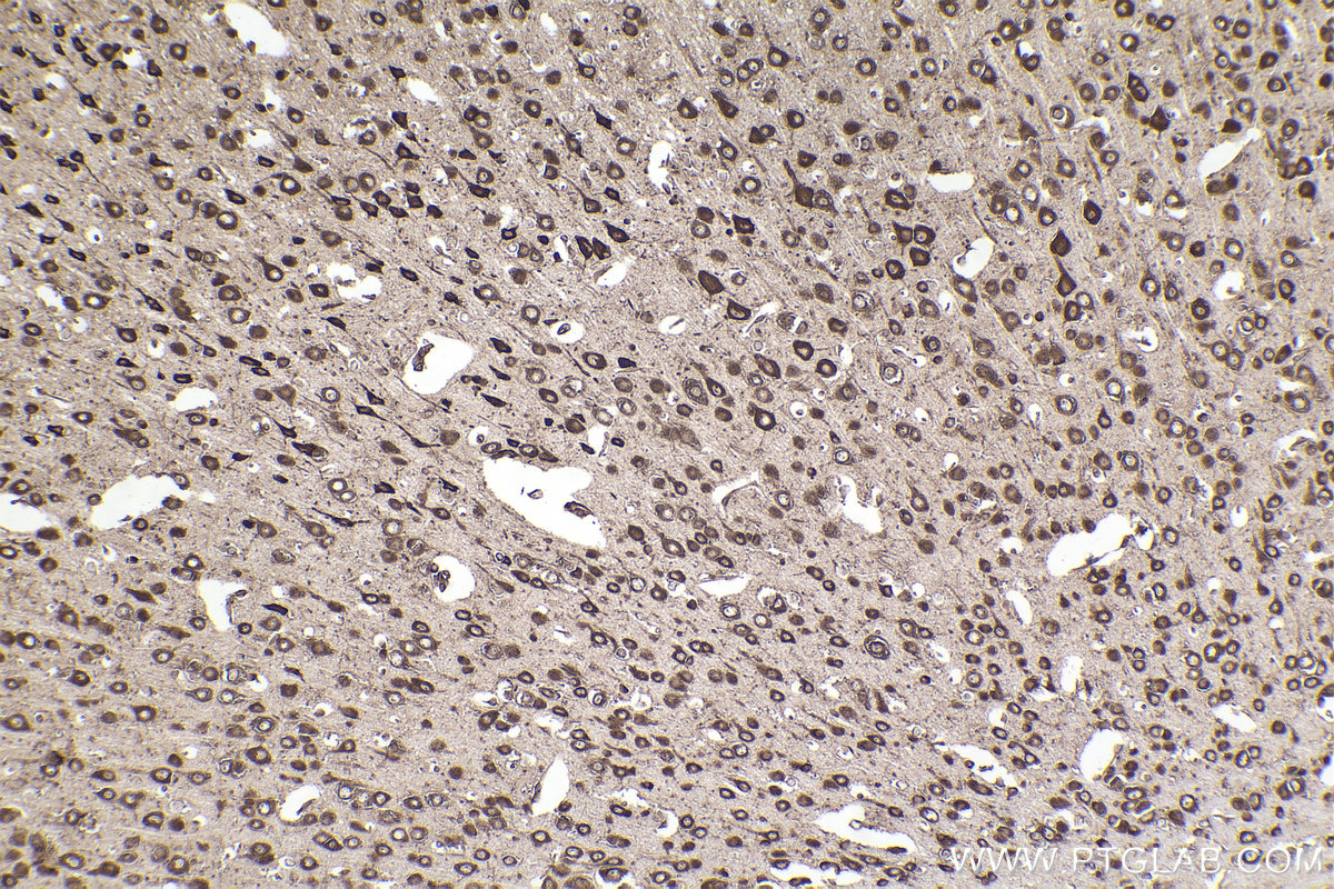 Immunohistochemistry (IHC) staining of mouse brain tissue using RPL12 Monoclonal antibody (68110-1-Ig)