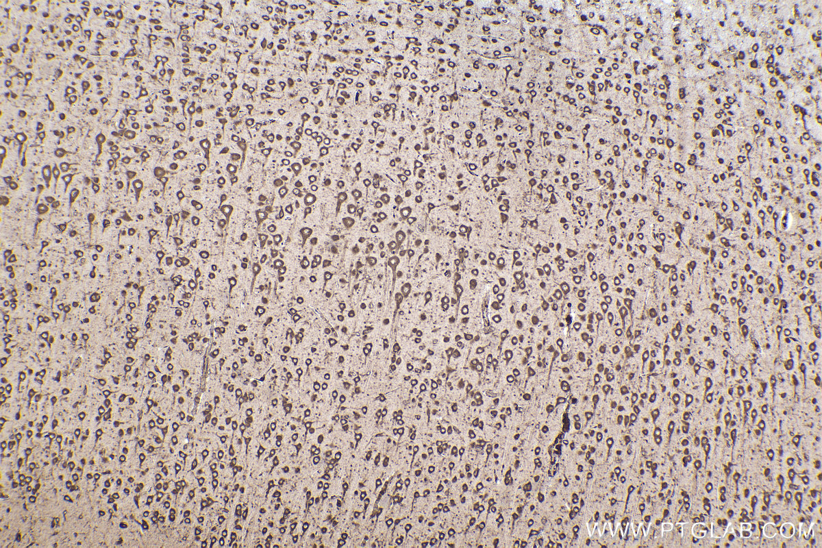 Immunohistochemistry (IHC) staining of rat brain tissue using RPL12 Monoclonal antibody (68110-1-Ig)