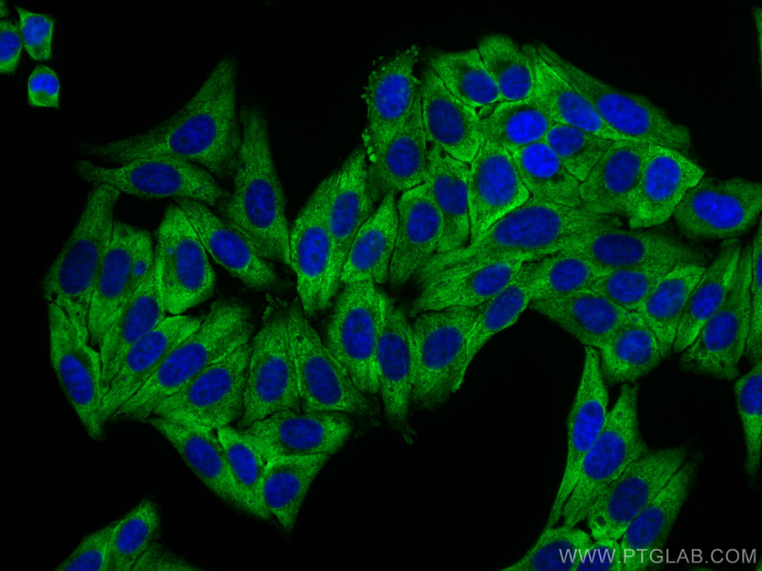 Immunofluorescence (IF) / fluorescent staining of HepG2 cells using RPL14 Recombinant antibody (82688-1-RR)