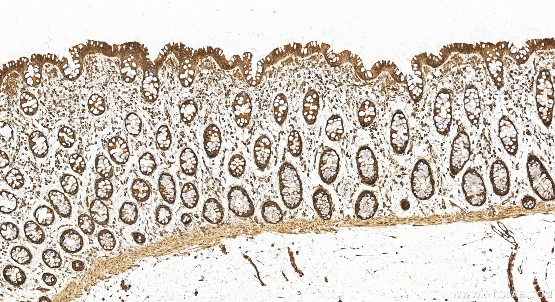 Immunohistochemistry (IHC) staining of human colon tissue using RPL15 Polyclonal antibody (16740-1-AP)