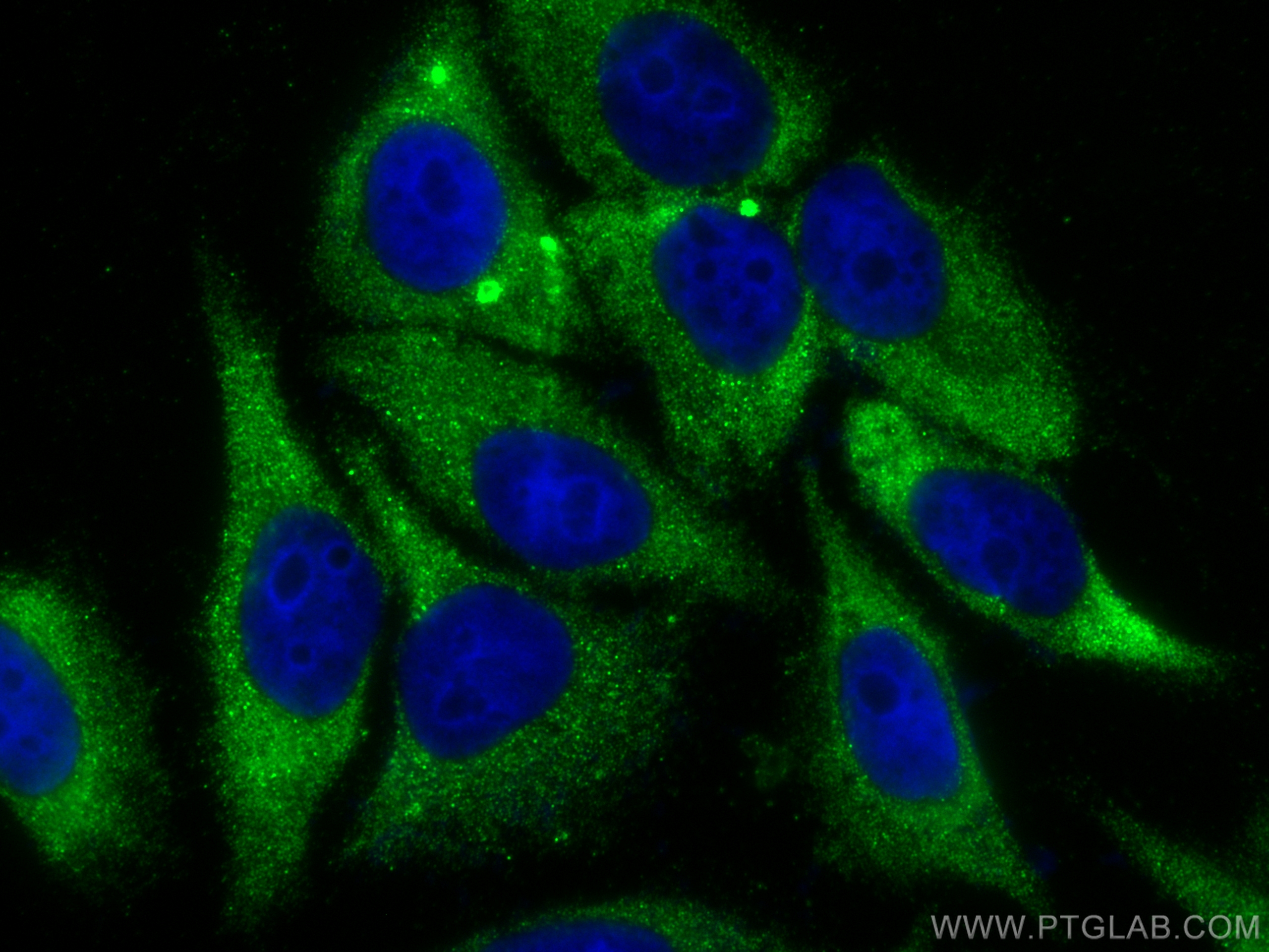 Immunofluorescence (IF) / fluorescent staining of HepG2 cells using RPL18A Polyclonal antibody (14653-1-AP)