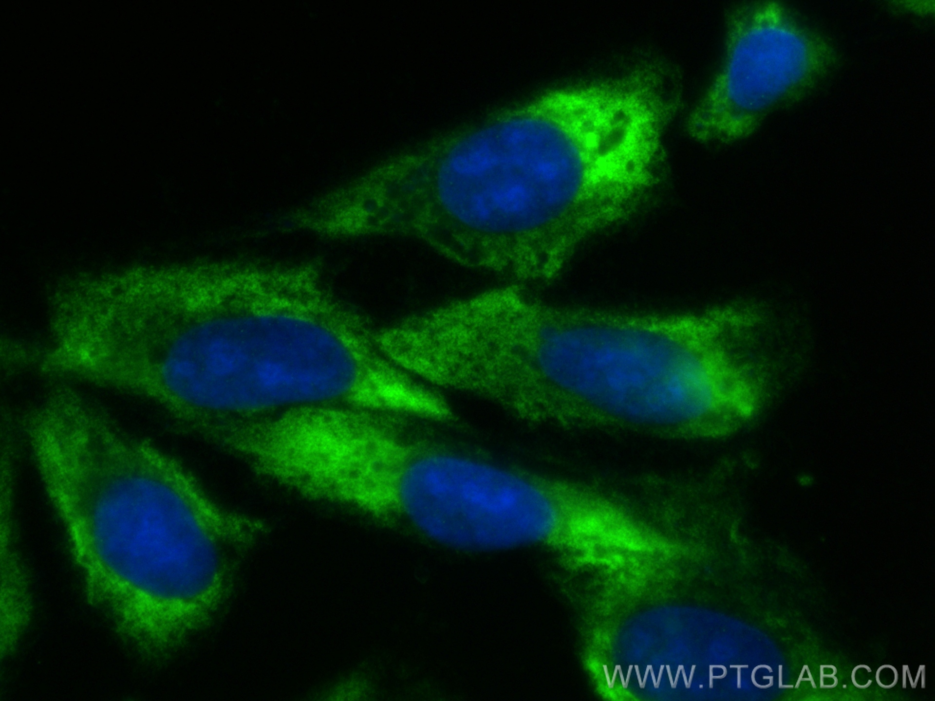 Immunofluorescence (IF) / fluorescent staining of U2OS cells using RPL21 Polyclonal antibody (15226-1-AP)