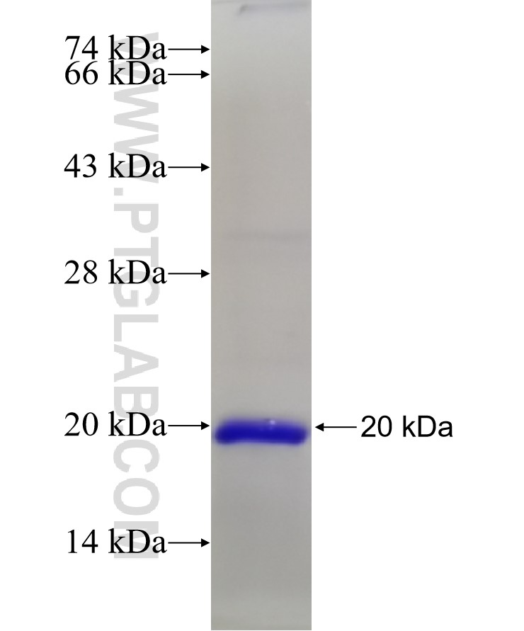 RPL22 fusion protein Ag21857 SDS-PAGE