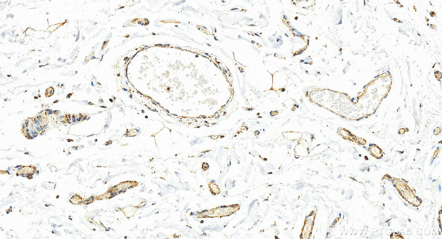 Immunohistochemistry (IHC) staining of human normal colon using RPL23A Polyclonal antibody (16386-1-AP)