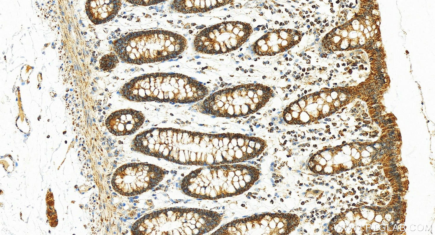 Immunohistochemistry (IHC) staining of human normal colon using RPL23A Polyclonal antibody (16386-1-AP)