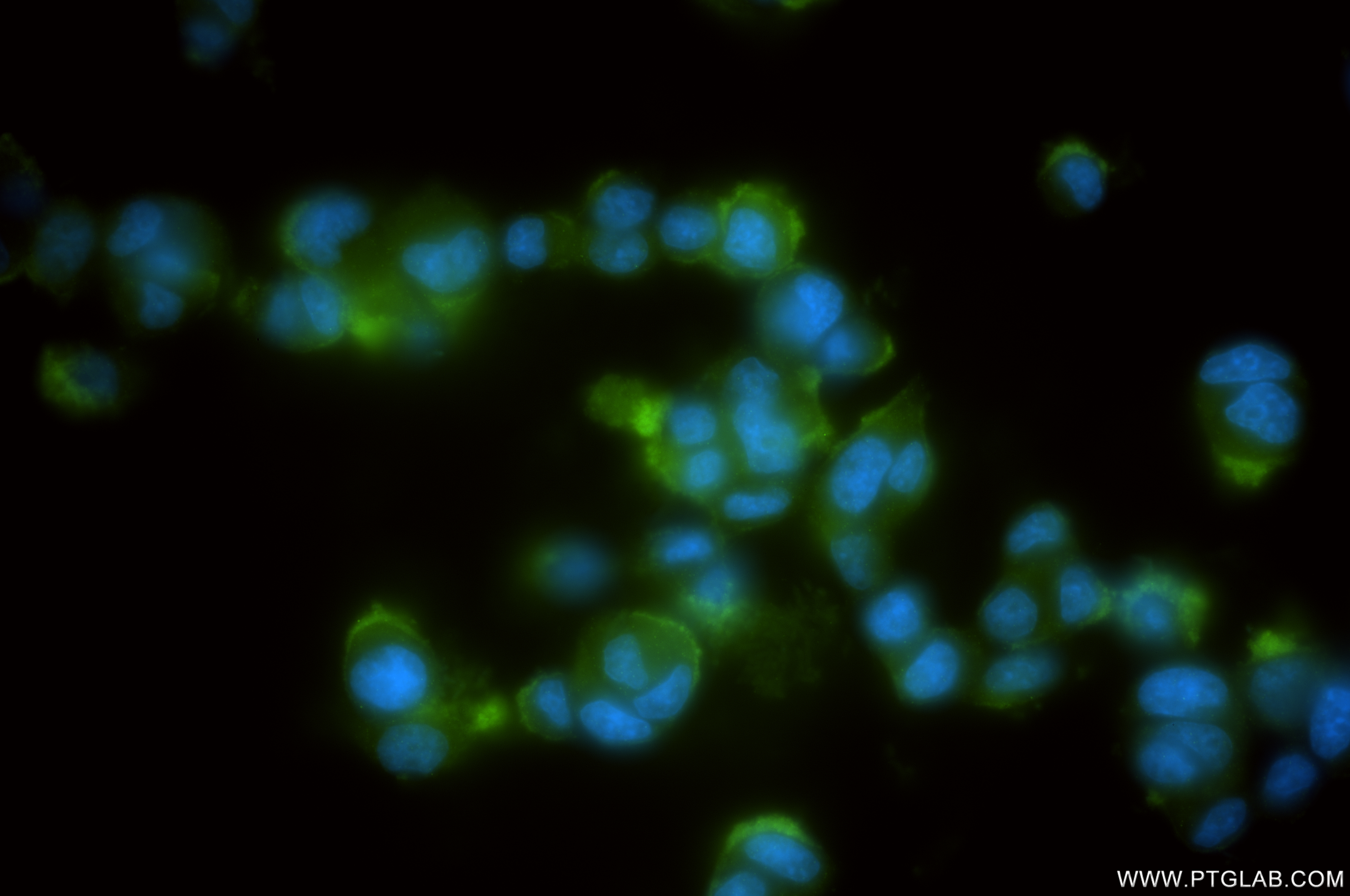 Immunofluorescence (IF) / fluorescent staining of PC-12 cells using RPL26 Recombinant antibody (85775-1-RR)