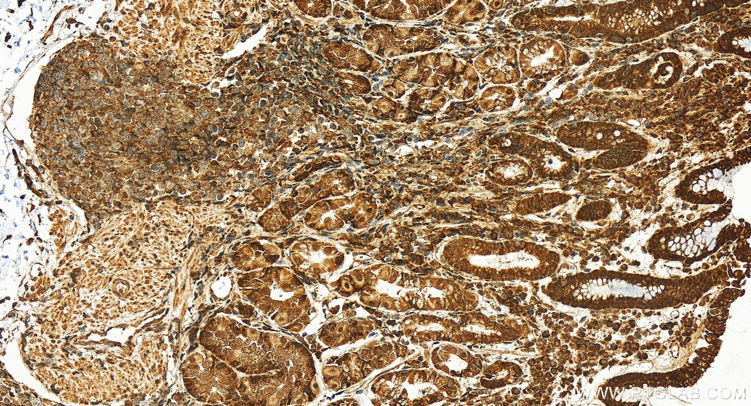 Immunohistochemistry (IHC) staining of human stomach tissue using RPL26L1 Polyclonal antibody (16487-1-AP)