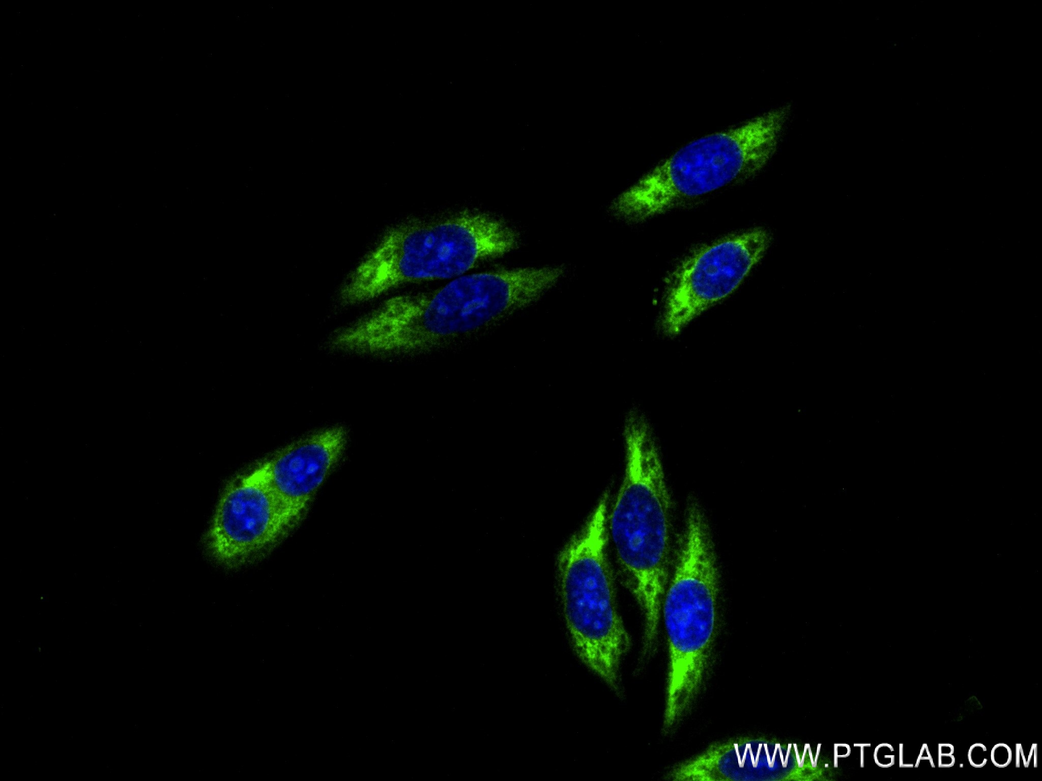 Immunofluorescence (IF) / fluorescent staining of HepG2 cells using RPL29 Recombinant antibody (83377-1-RR)