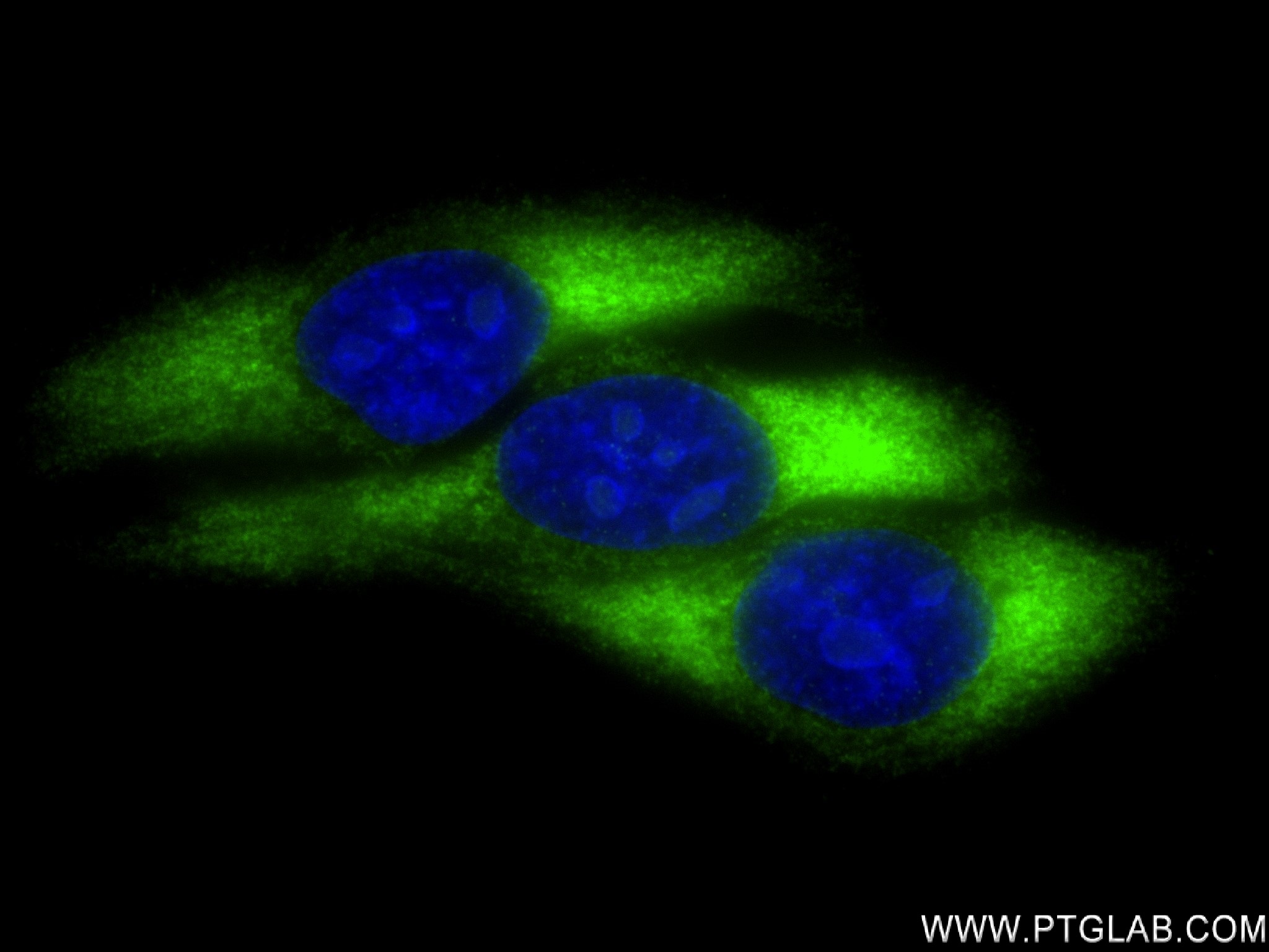 Immunofluorescence (IF) / fluorescent staining of HepG2 cells using RPL29 Recombinant antibody (83377-1-RR)