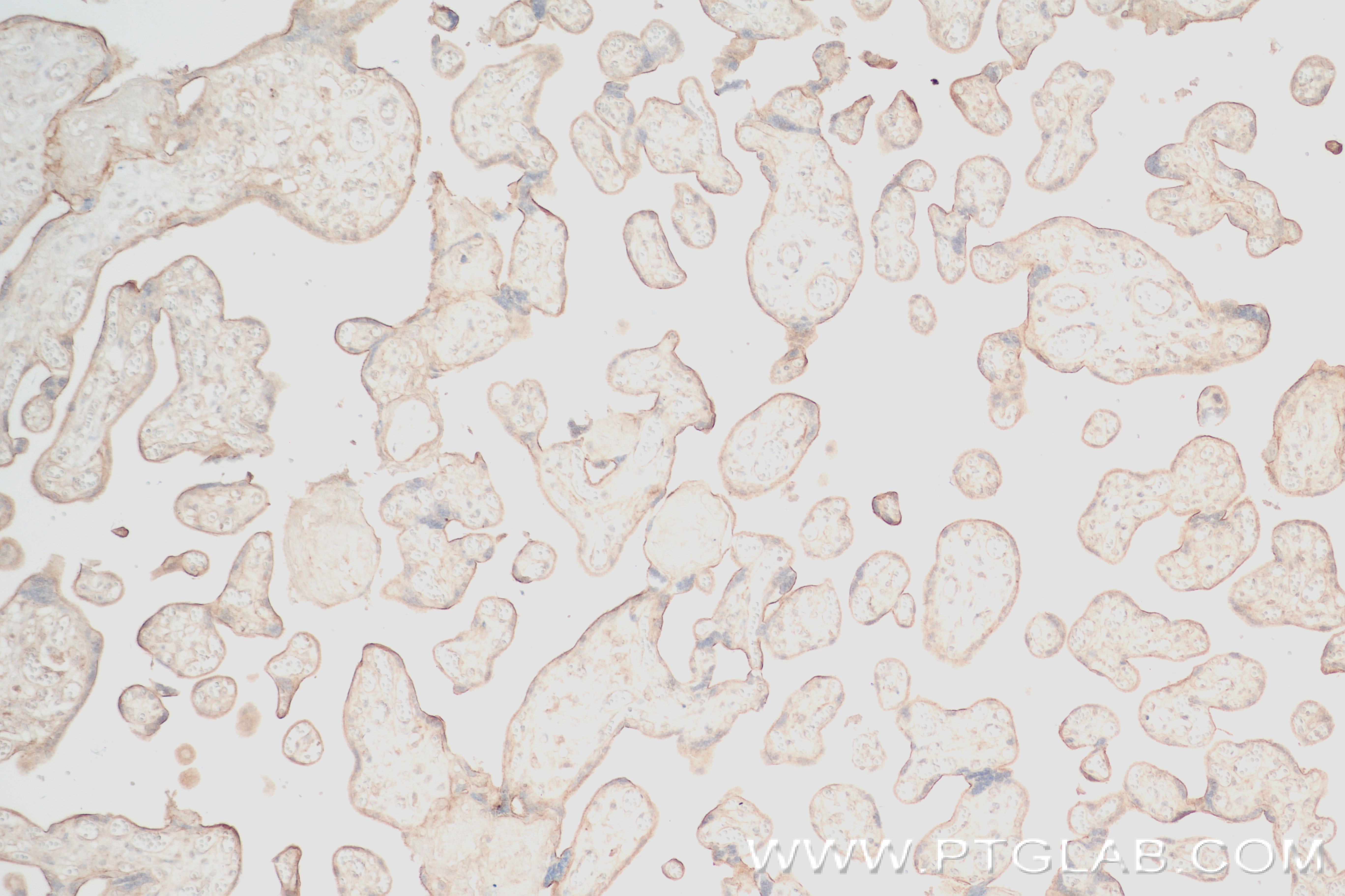 Immunohistochemistry (IHC) staining of human placenta tissue using RPL3 Recombinant antibody (82815-1-RR)