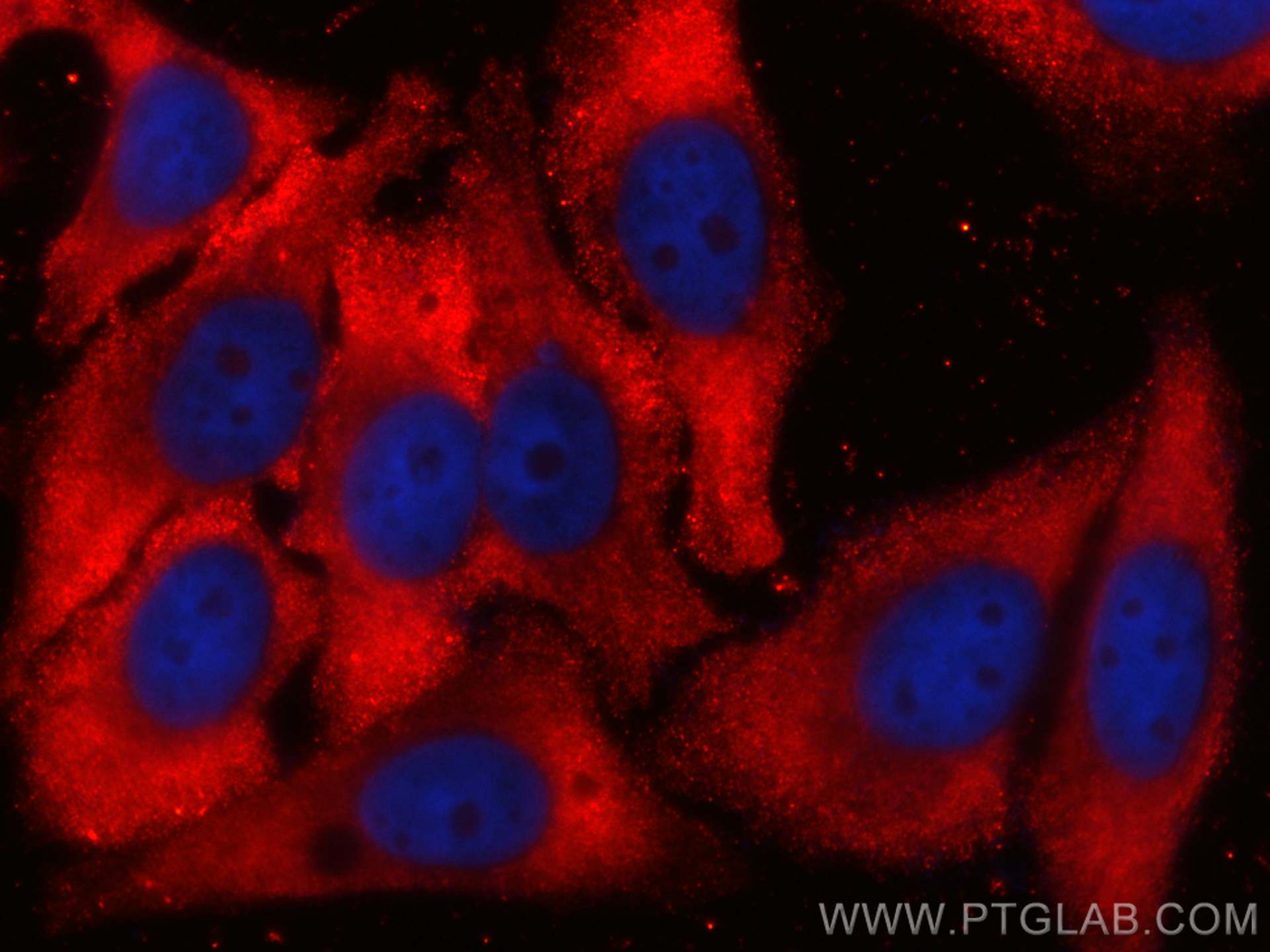 Immunofluorescence (IF) / fluorescent staining of HepG2 cells using CoraLite®594-conjugated RPL3 Monoclonal antibody (CL594-66130)