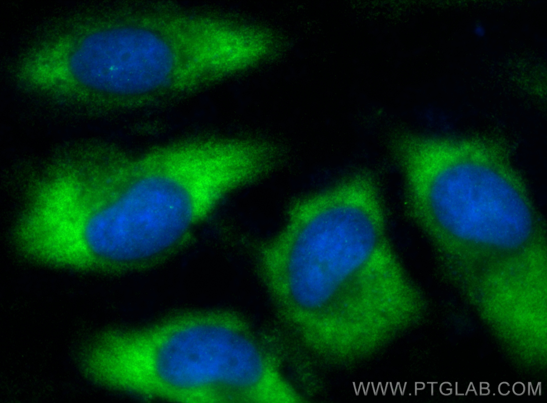 Immunofluorescence (IF) / fluorescent staining of HeLa cells using RPL36 Polyclonal antibody (15145-1-AP)