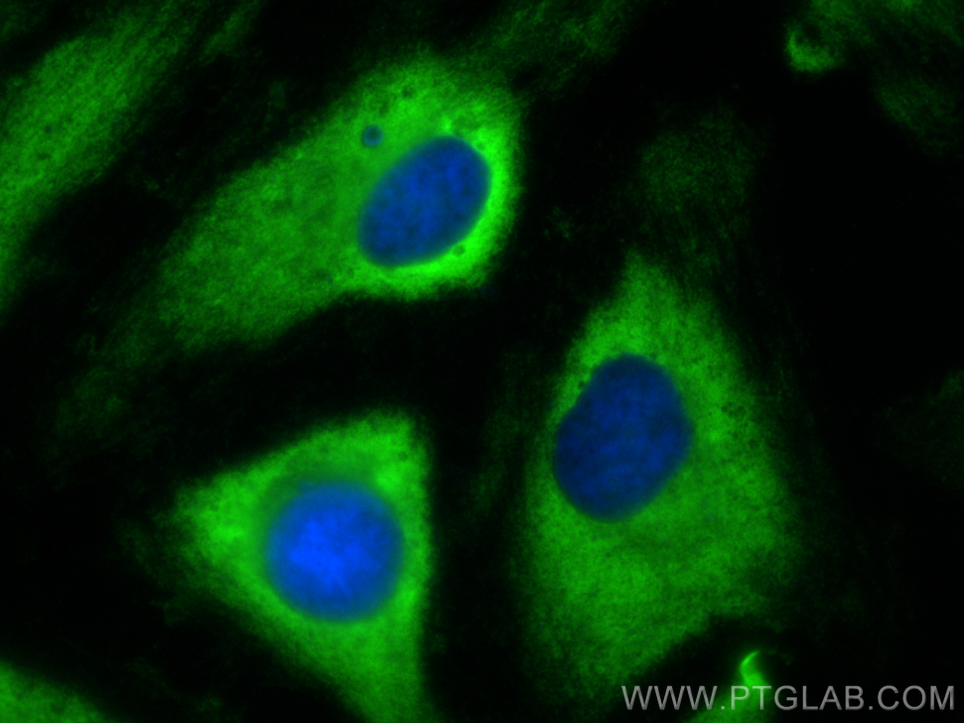 Immunofluorescence (IF) / fluorescent staining of HeLa cells using Ribosomal protein L4 Polyclonal antibody (11302-1-AP)