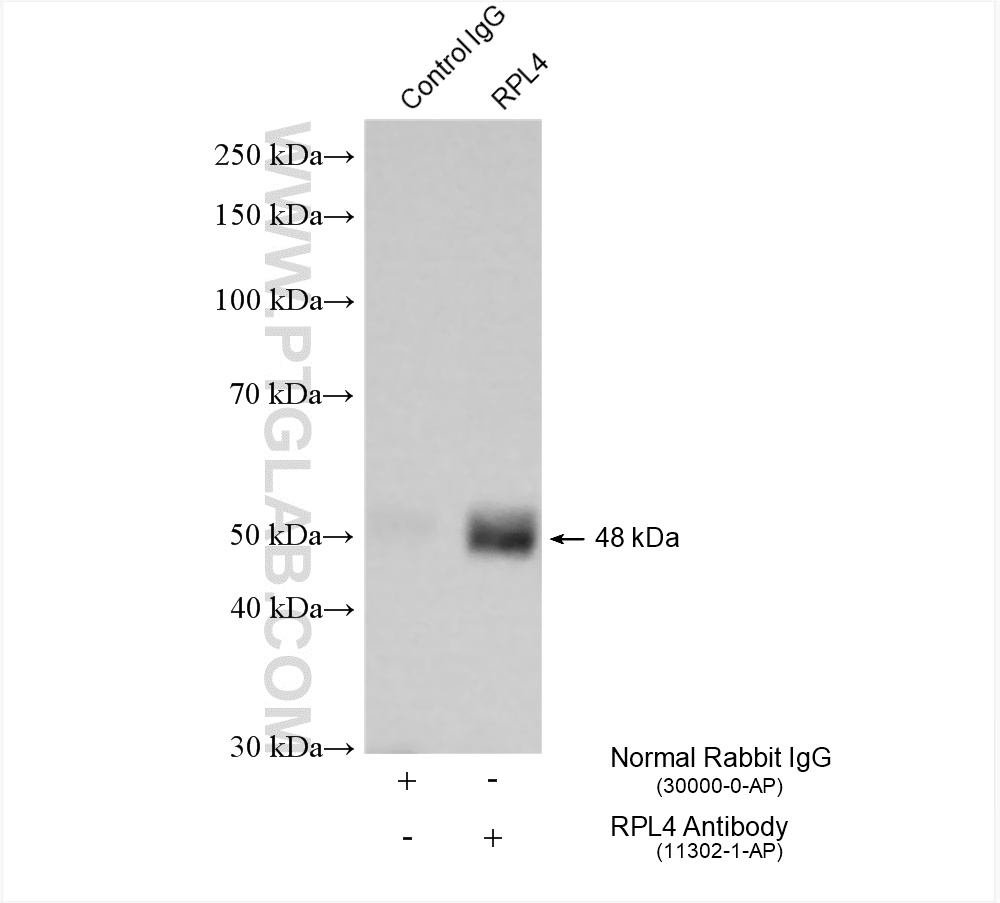 Immunoprecipitation (IP) experiment of HeLa cells using Ribosomal protein L4 Polyclonal antibody (11302-1-AP)