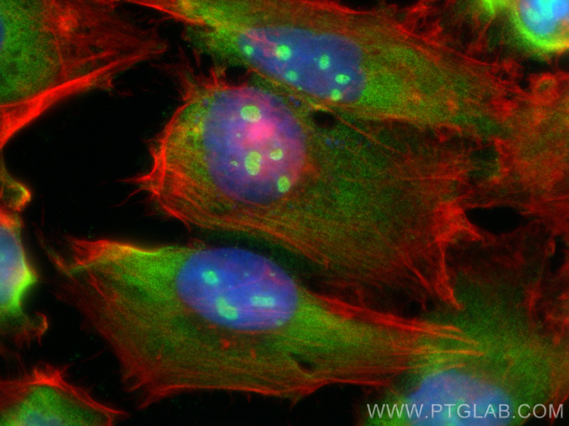 Immunofluorescence (IF) / fluorescent staining of U-251 cells using RPL5 Polyclonal antibody (29092-1-AP)