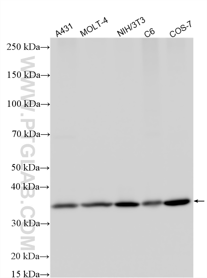 Western Blot (WB) analysis of various lysates using RPL5 Polyclonal antibody (29092-1-AP)