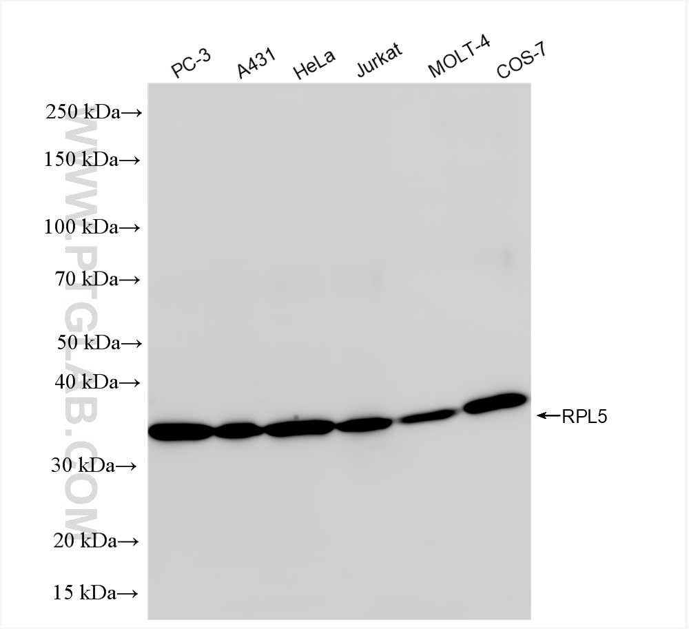 Western Blot (WB) analysis of various lysates using RPL5 Recombinant antibody (85348-1-RR)
