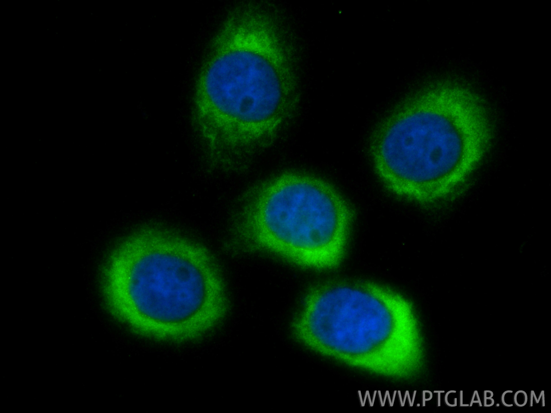 Immunofluorescence (IF) / fluorescent staining of A431 cells using RPL7 Polyclonal antibody (14583-1-AP)