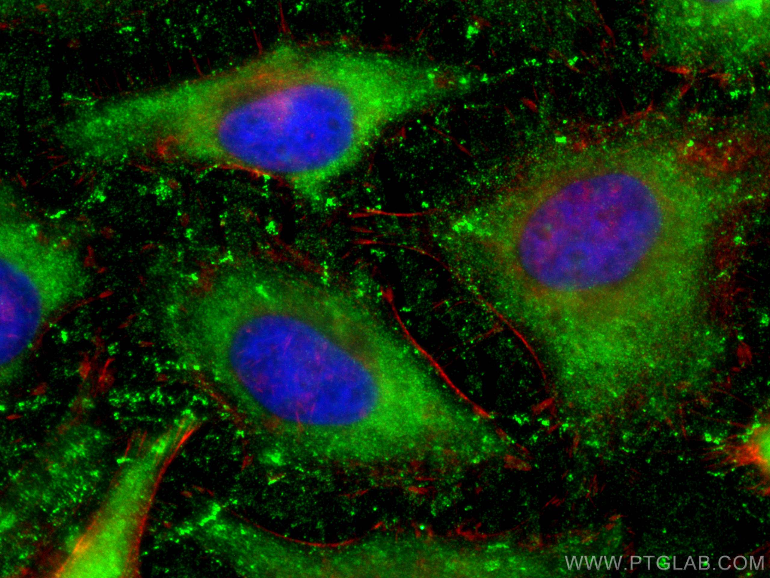 Immunofluorescence (IF) / fluorescent staining of HeLa cells using RPLP1 Polyclonal antibody (21636-1-AP)