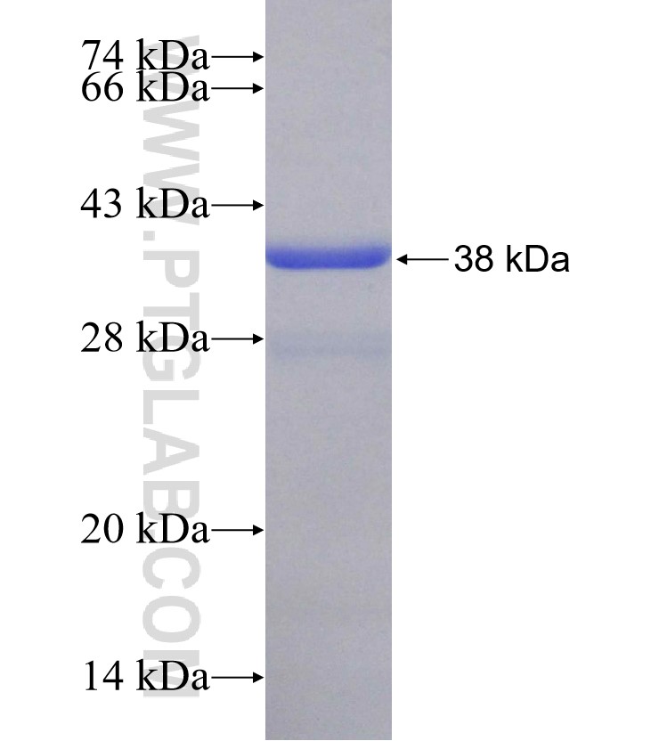 RPLP2 fusion protein Ag29455 SDS-PAGE