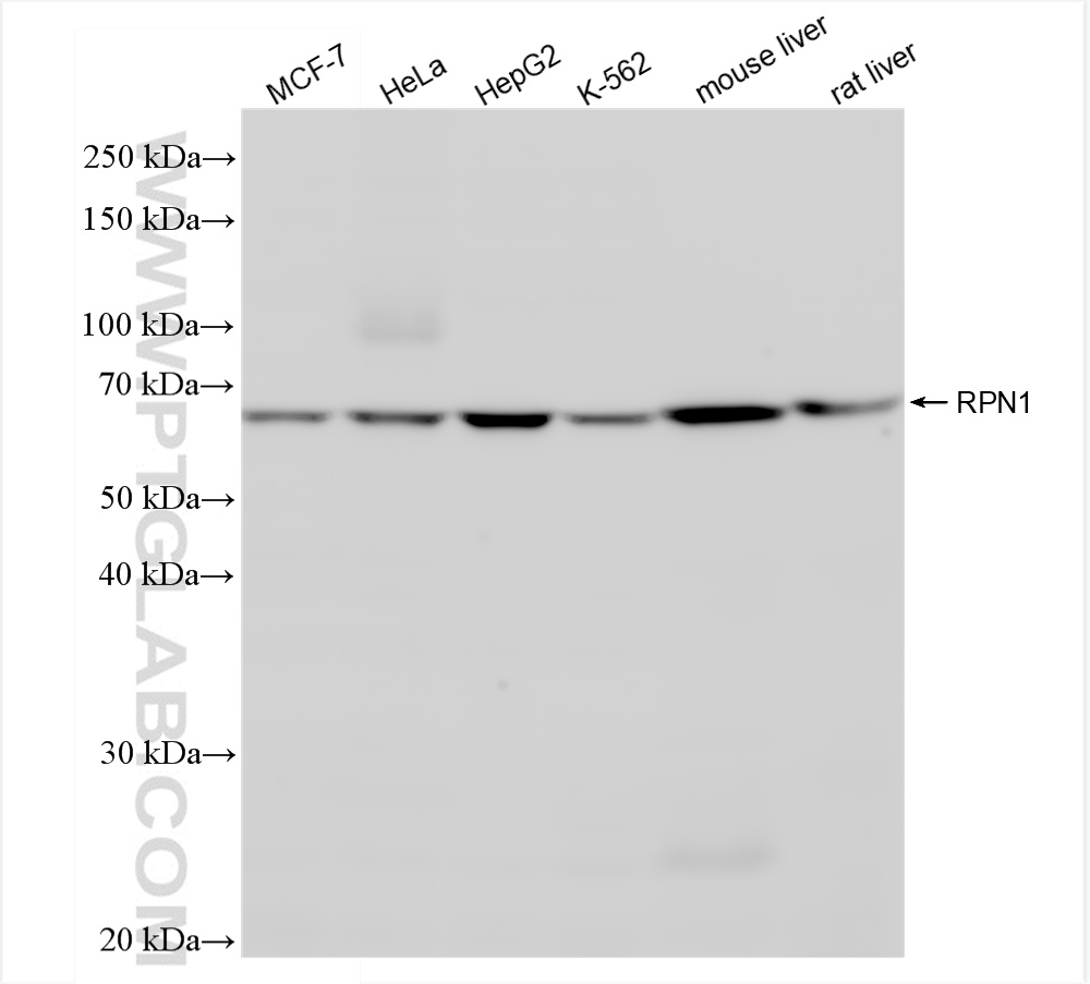 Western Blot (WB) analysis of various lysates using RPN1 Recombinant antibody (83250-2-RR)