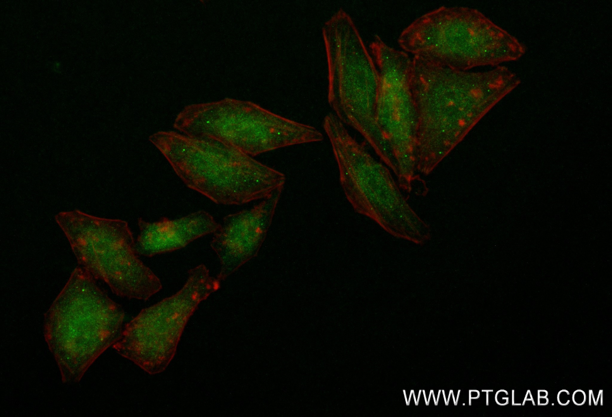 Immunofluorescence (IF) / fluorescent staining of HepG2 cells using RPS11 Recombinant antibody (83517-3-RR)