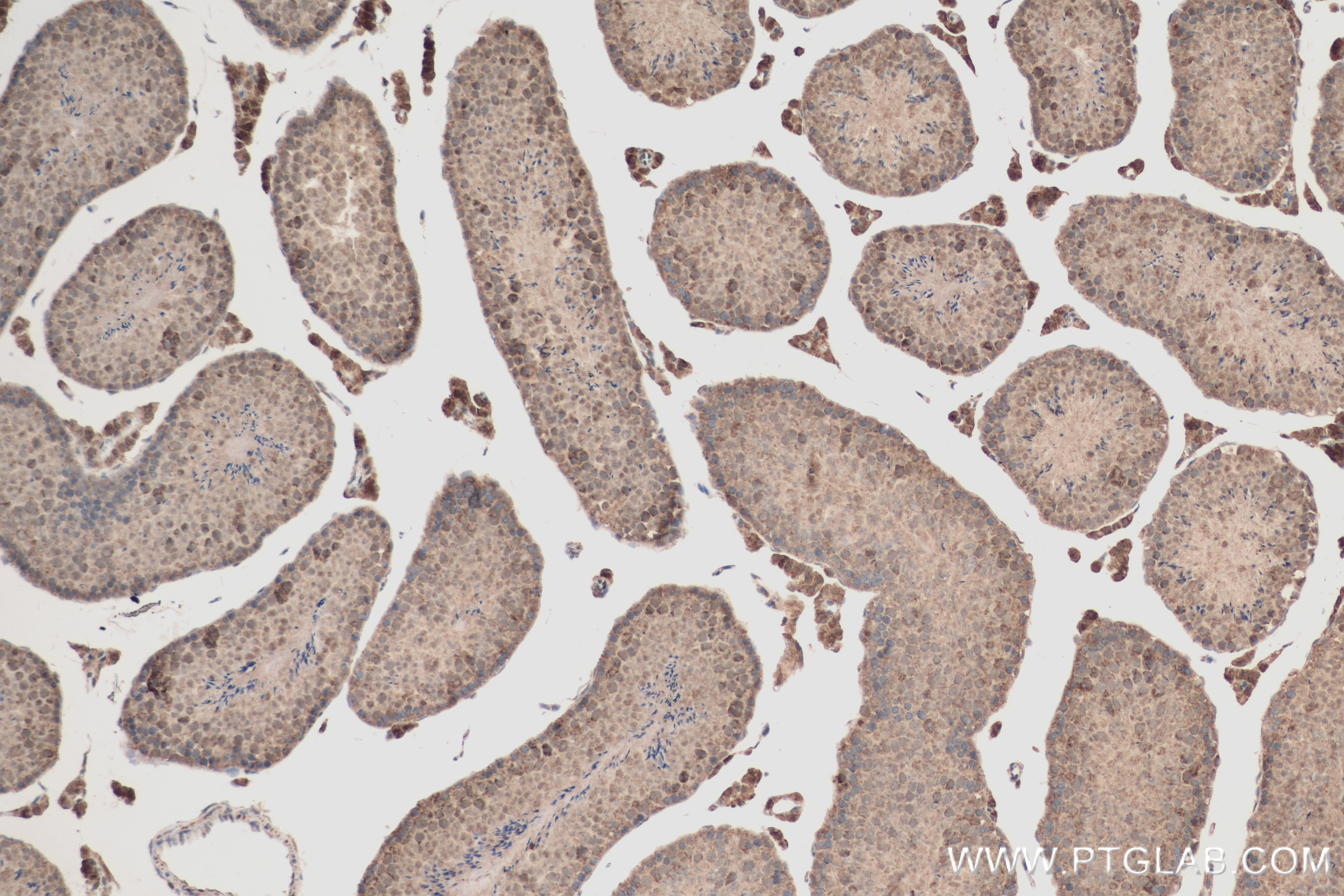 Immunohistochemistry (IHC) staining of mouse testis tissue using RPS11 Recombinant antibody (83517-3-RR)