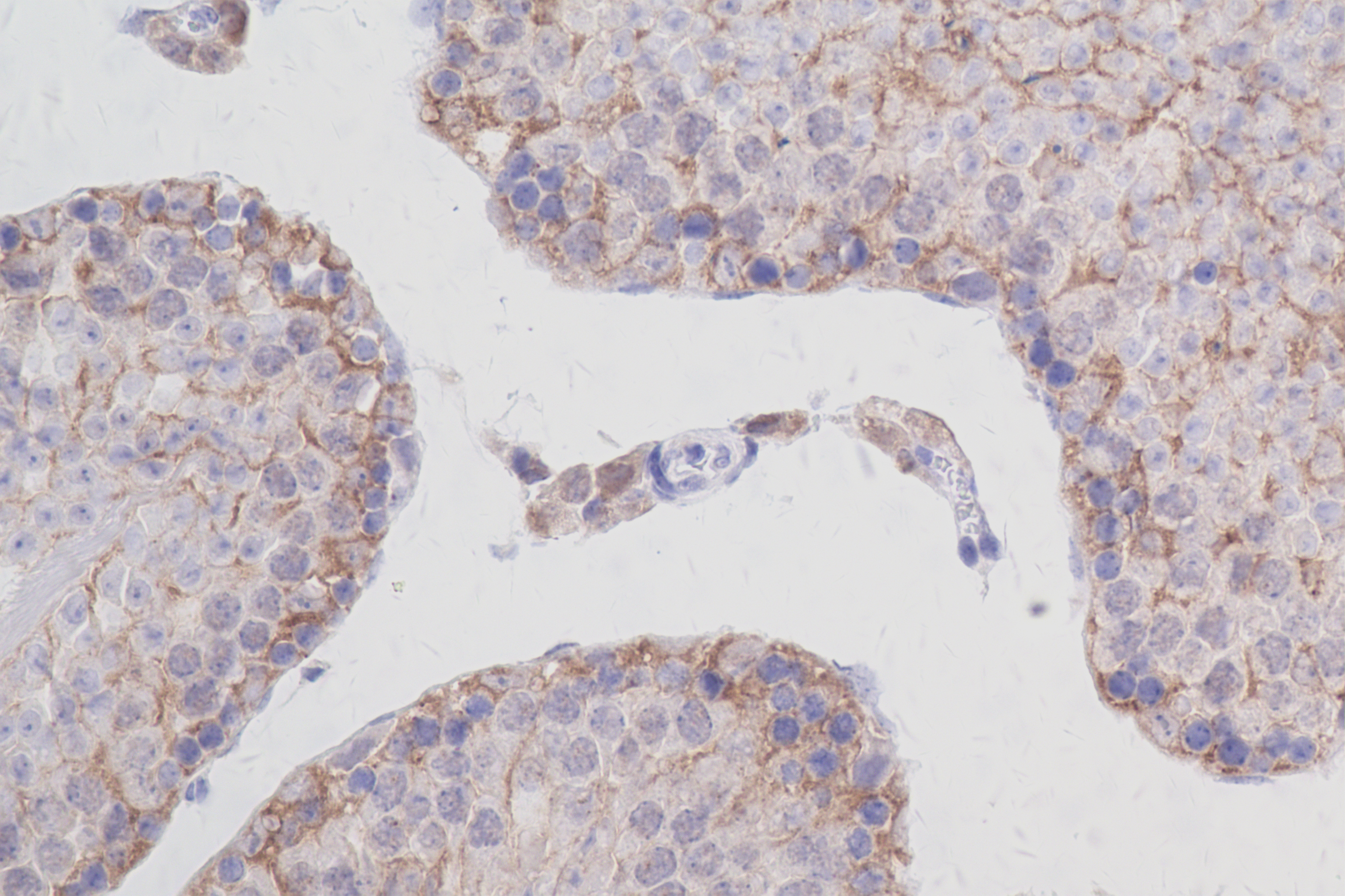 Immunohistochemistry (IHC) staining of mouse testis tissue using RPS11 Recombinant antibody (83517-3-RR)