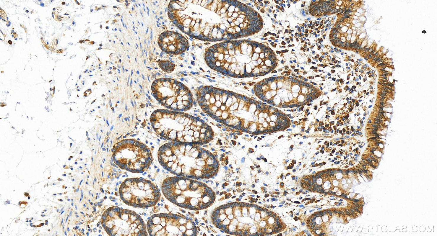 Immunohistochemistry (IHC) staining of human  colon using RPS14 Polyclonal antibody (16683-1-AP)