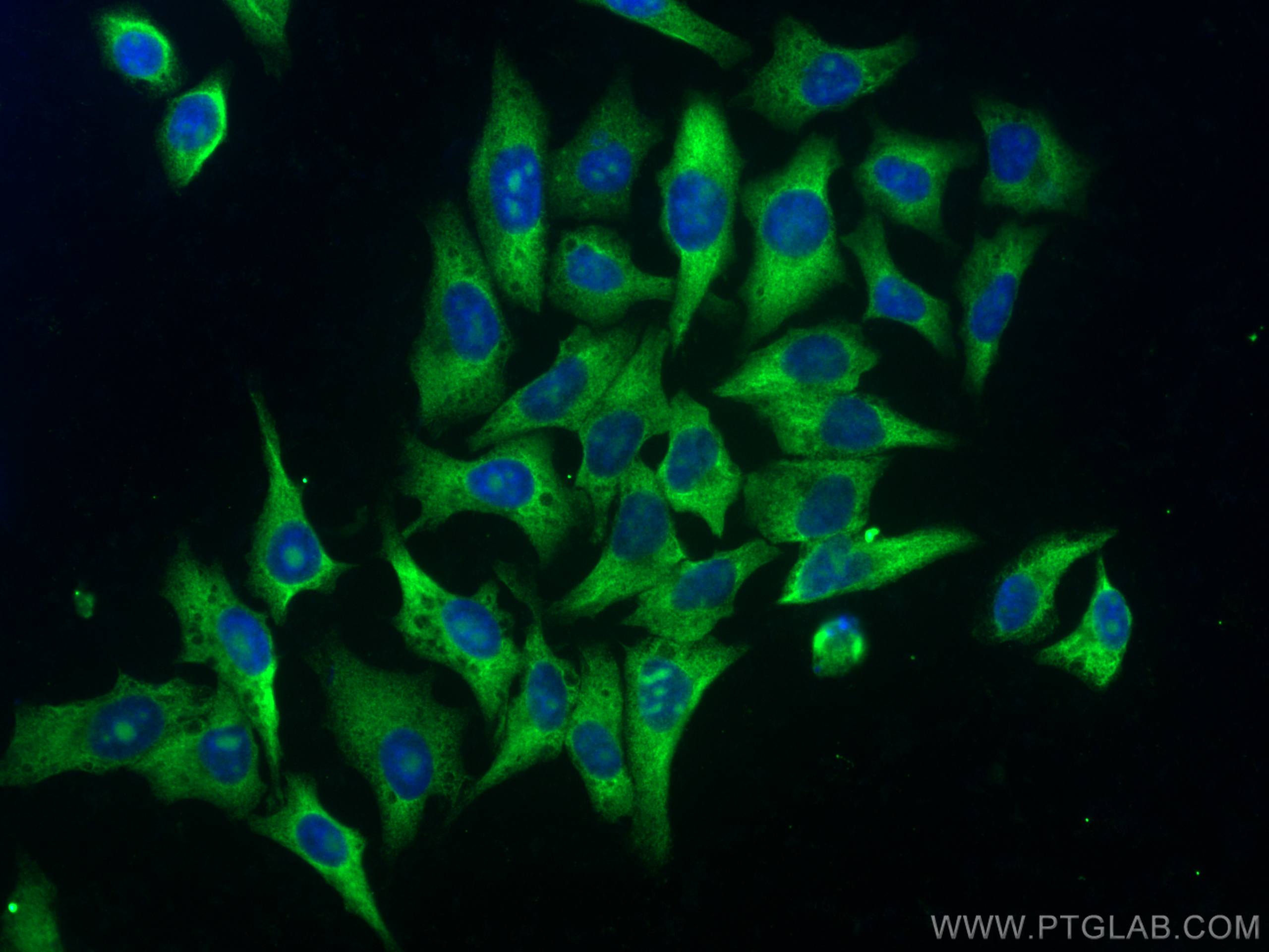 Immunofluorescence (IF) / fluorescent staining of HepG2 cells using RPS14 Monoclonal antibody (67566-1-Ig)