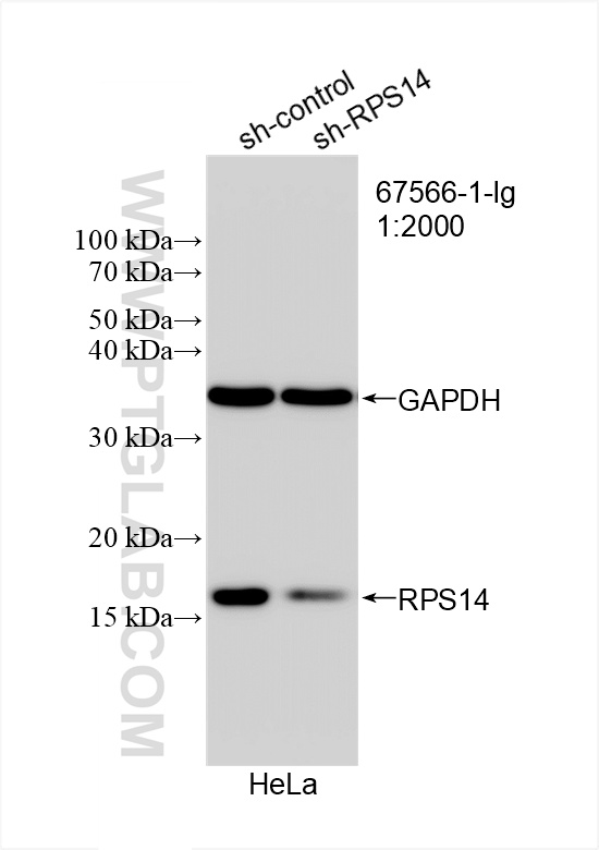 Western Blot (WB) analysis of HeLa cells using RPS14 Monoclonal antibody (67566-1-Ig)