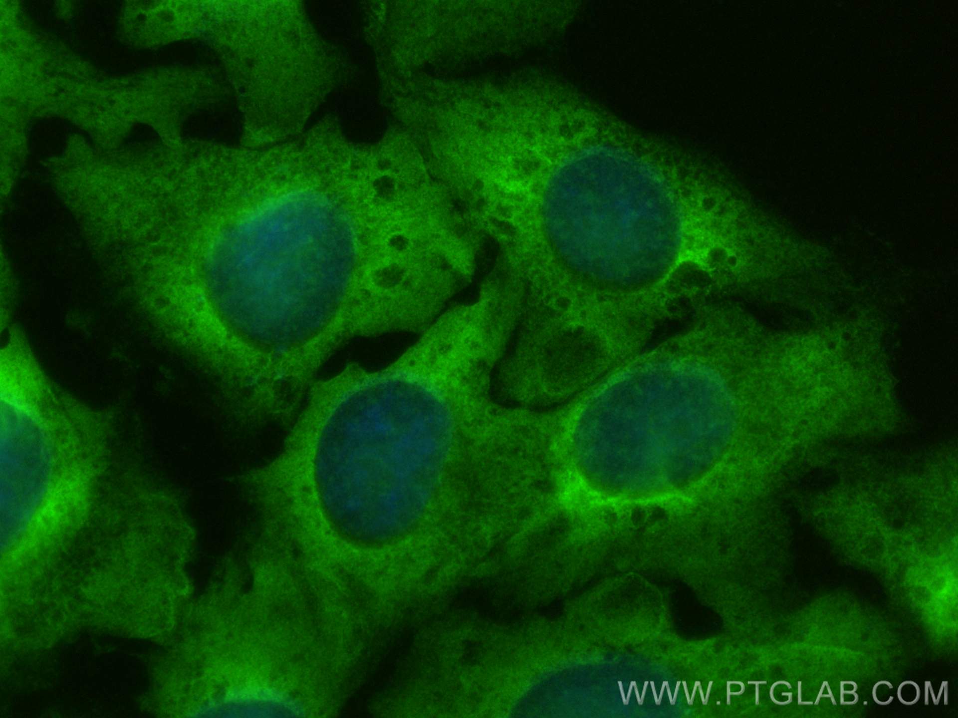 Immunofluorescence (IF) / fluorescent staining of U2OS cells using RPS17 Polyclonal antibody (16267-1-AP)