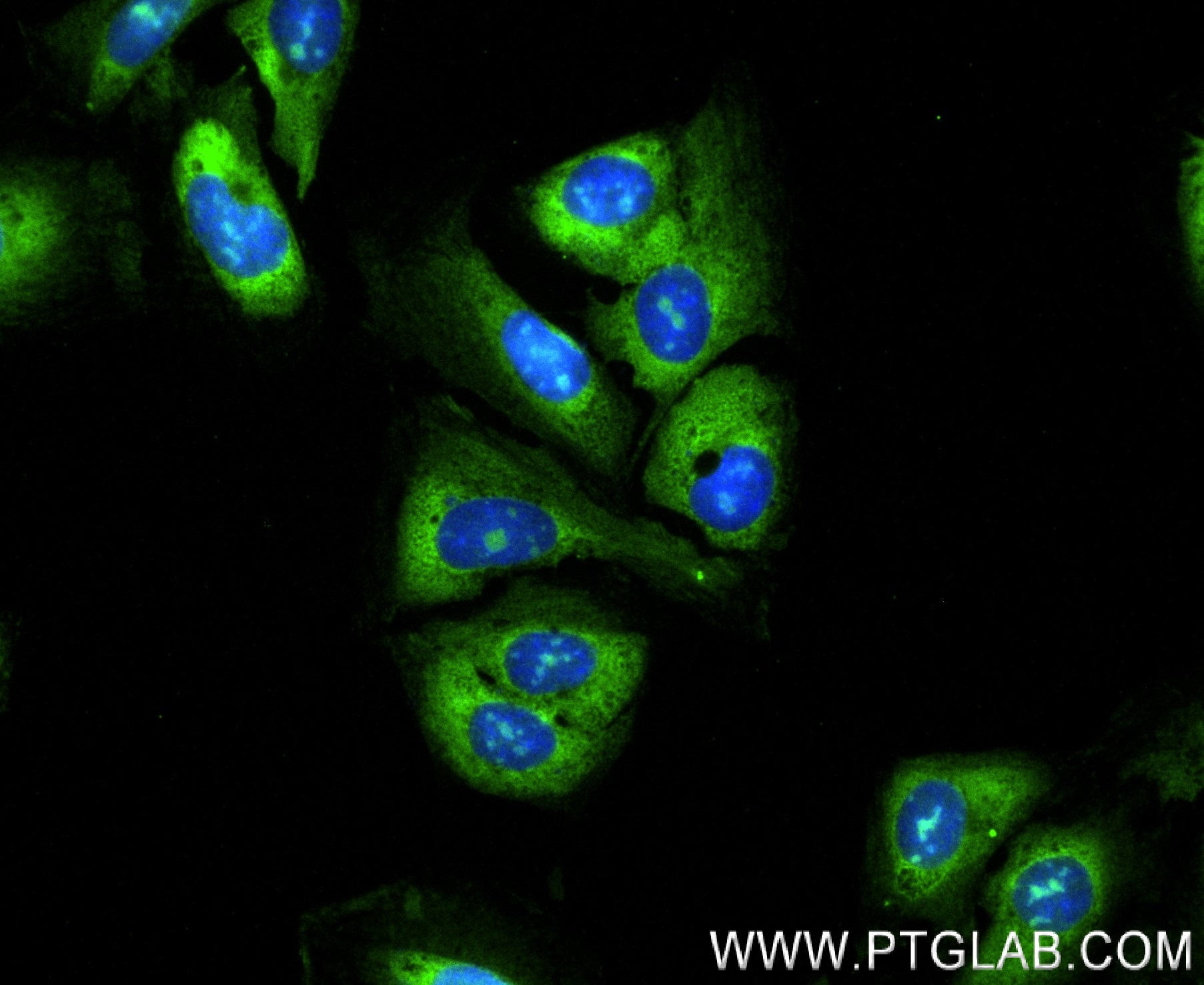 Immunofluorescence (IF) / fluorescent staining of U2OS cells using RPS17 Recombinant antibody (83848-4-RR)