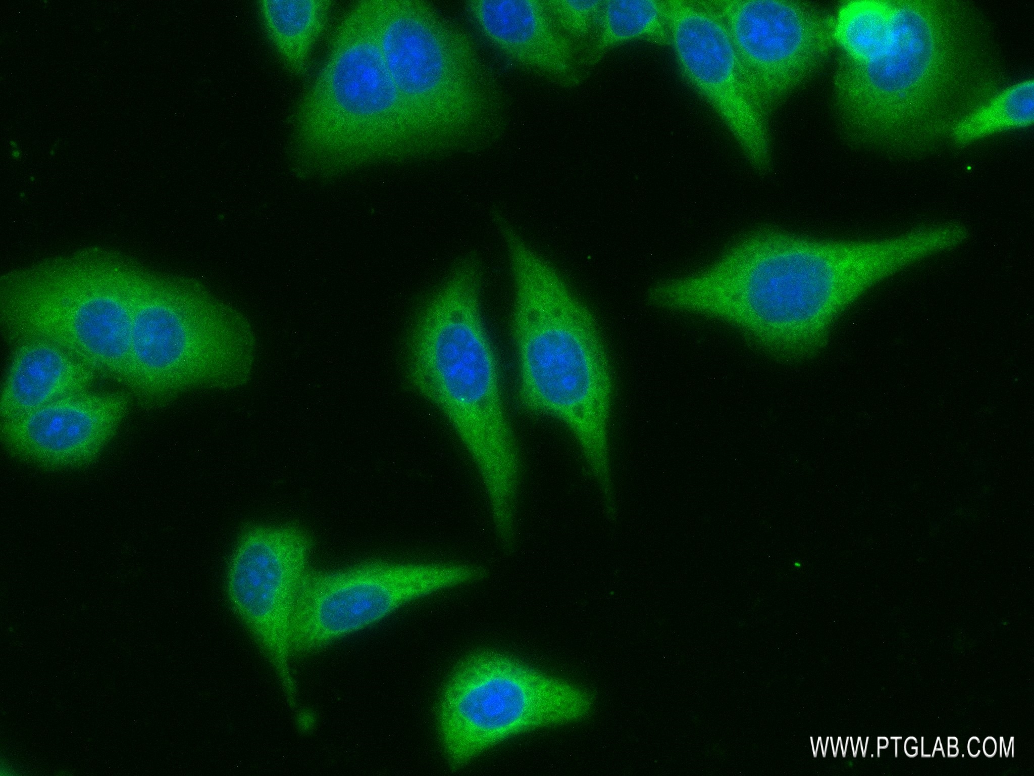 Immunofluorescence (IF) / fluorescent staining of HepG2 cells using RPS18 Recombinant antibody (83327-1-RR)