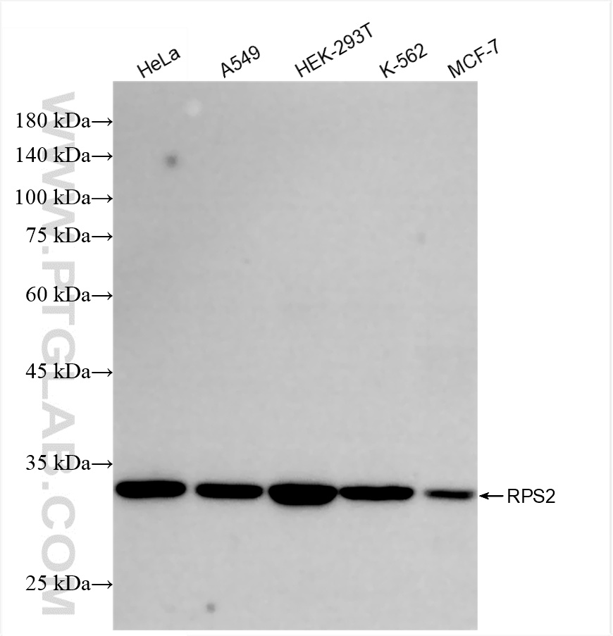 Western Blot (WB) analysis of various lysates using RPS2 Recombinant antibody (85956-1-RR)