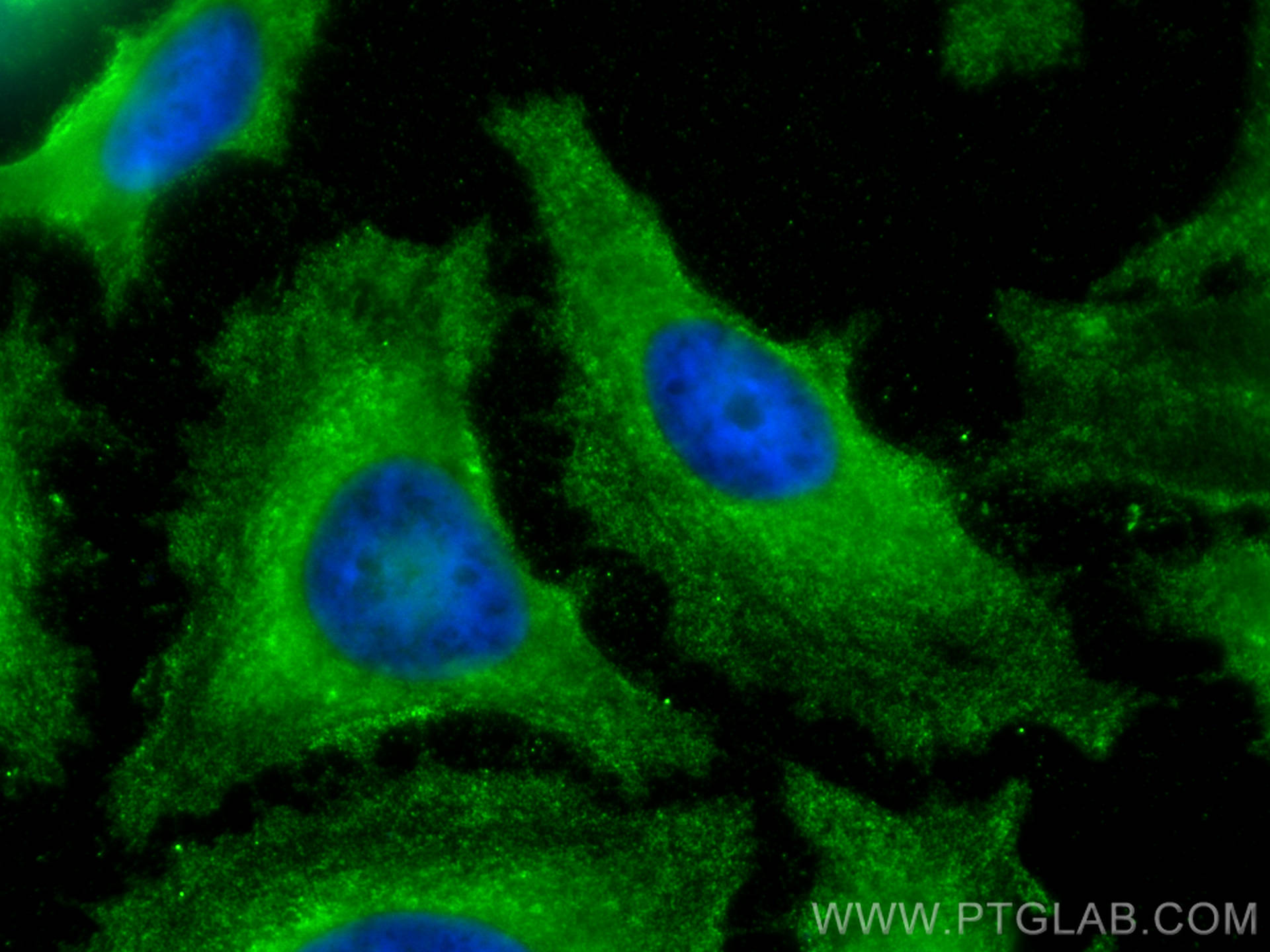 Immunofluorescence (IF) / fluorescent staining of HeLa cells using RPS20 Monoclonal antibody (68270-1-Ig)