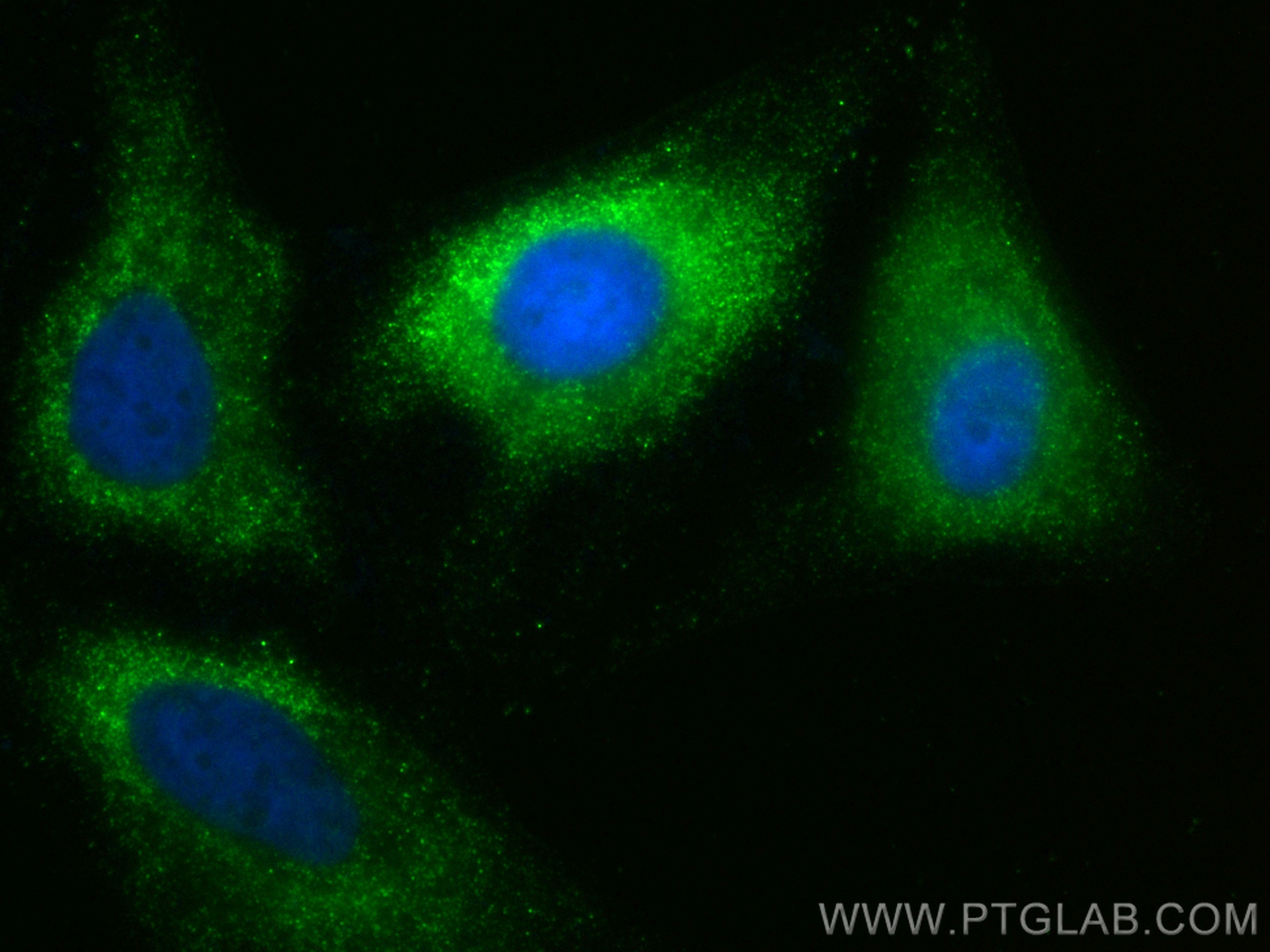 Immunofluorescence (IF) / fluorescent staining of HeLa cells using CoraLite® Plus 488-conjugated RPS20 Monoclonal ant (CL488-68270)