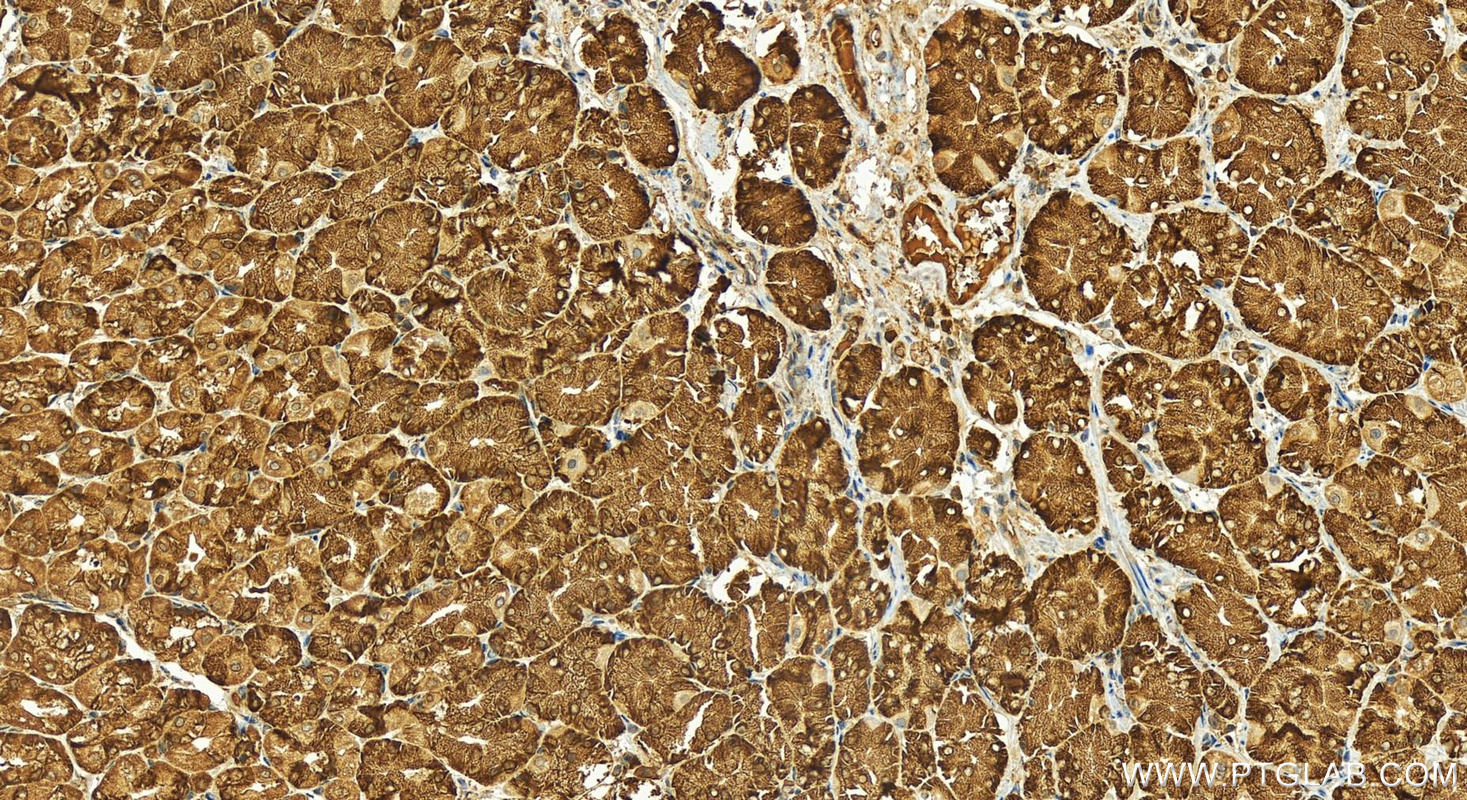 Immunohistochemistry (IHC) staining of human stomach tissue using RPS27L Polyclonal antibody (15871-1-AP)