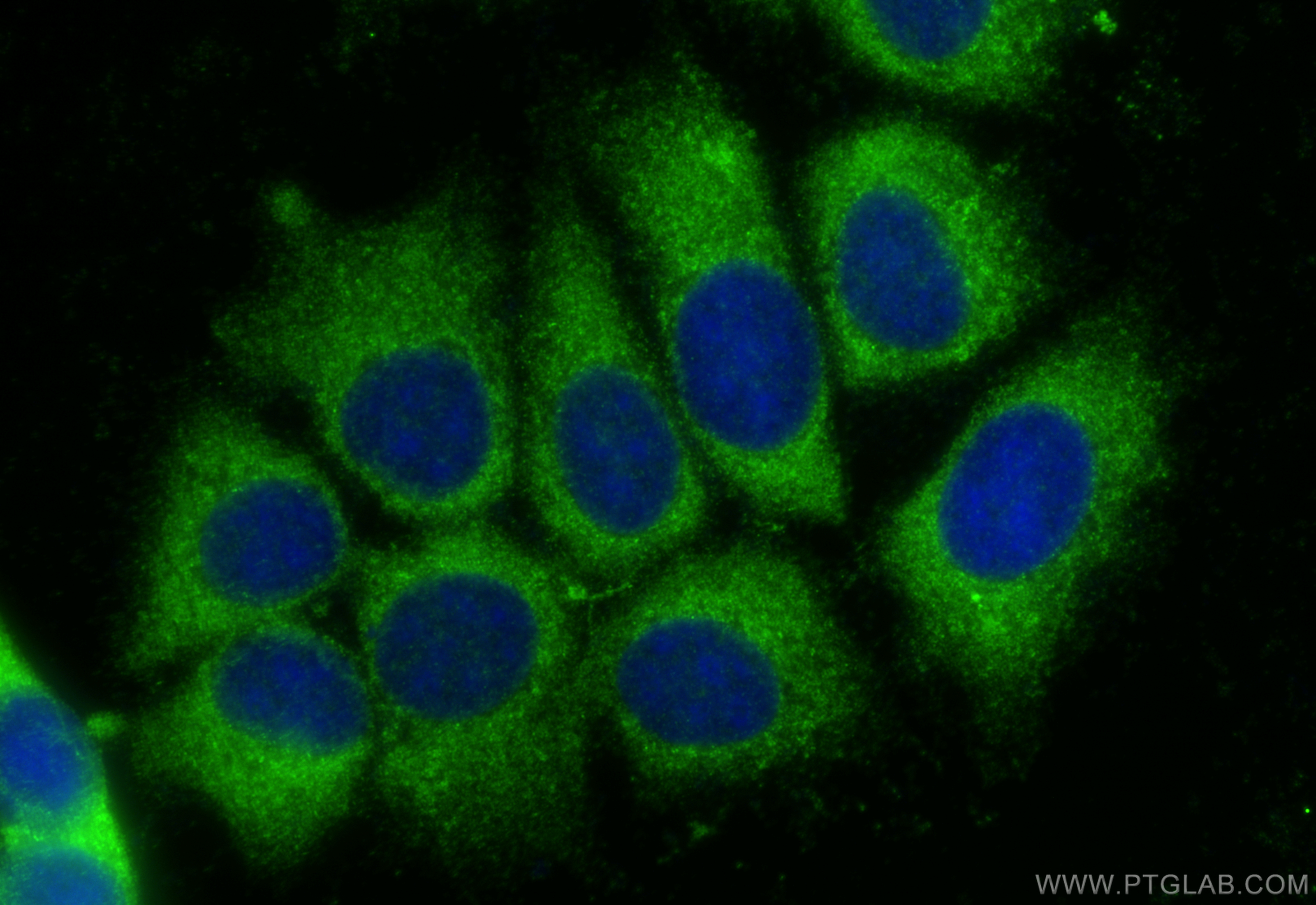 Immunofluorescence (IF) / fluorescent staining of MCF-7 cells using RPS3 Polyclonal antibody (11990-1-AP)