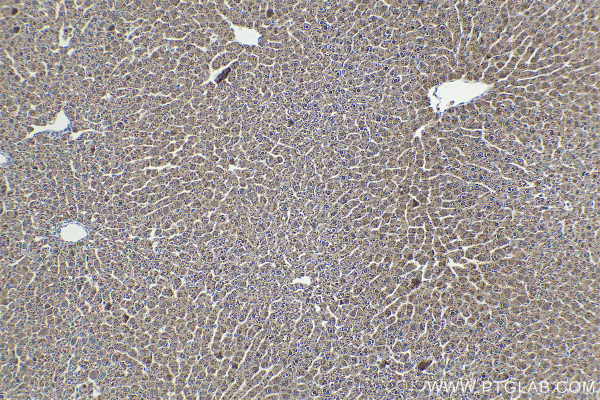 Immunohistochemistry (IHC) staining of rat liver tissue using RPS3 Polyclonal antibody (11990-1-AP)