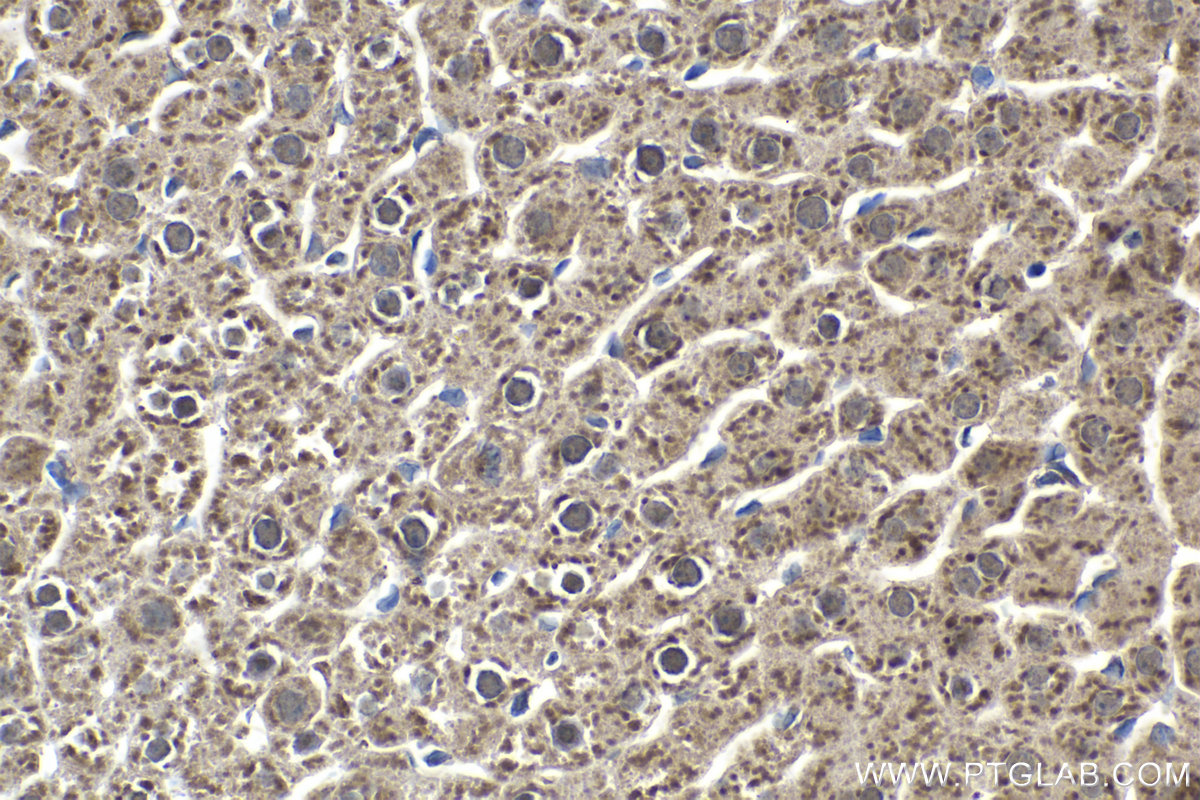 Immunohistochemistry (IHC) staining of rat liver tissue using RPS3 Polyclonal antibody (11990-1-AP)