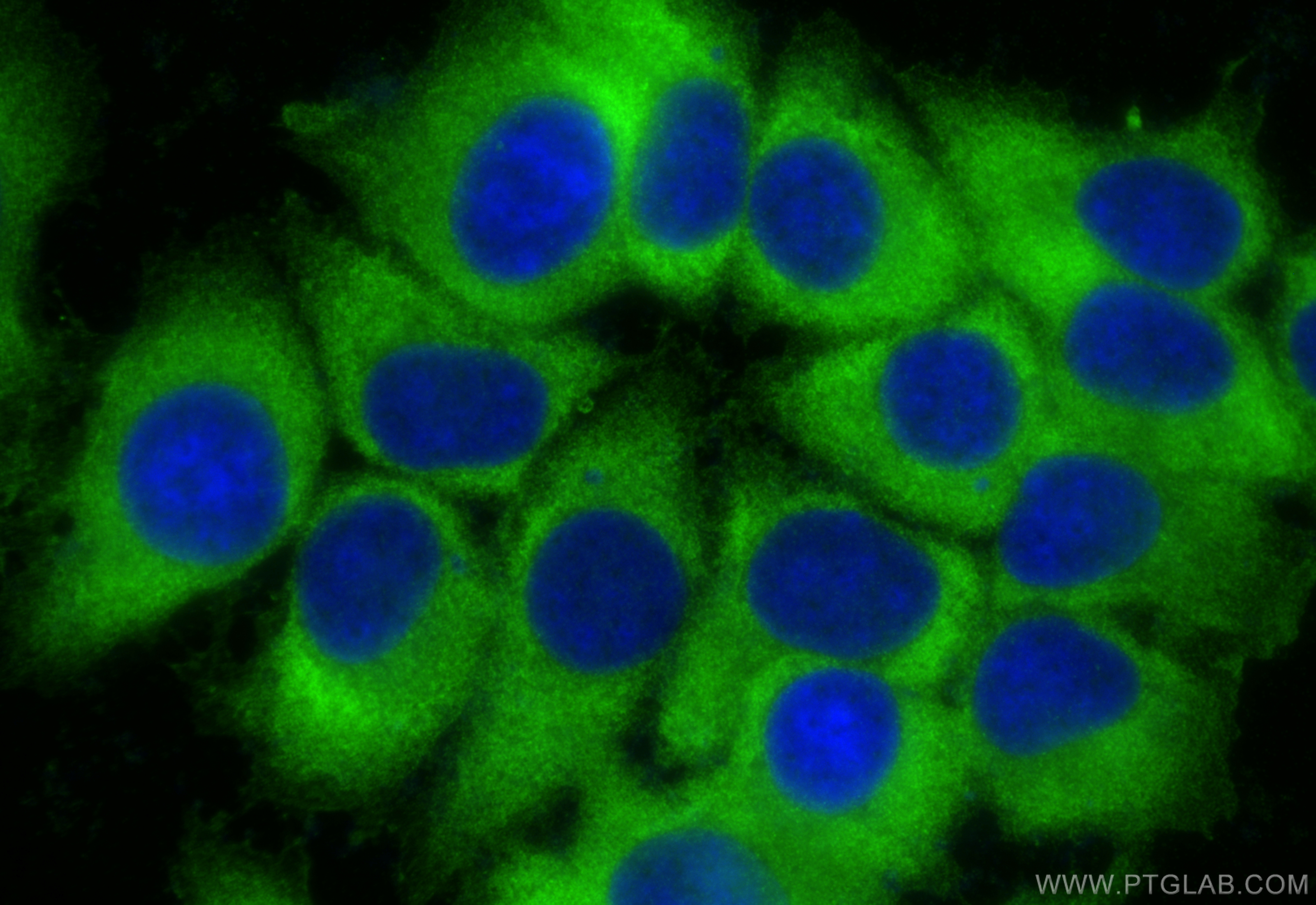 Immunofluorescence (IF) / fluorescent staining of MCF-7 cells using RPS3 Polyclonal antibody (15198-1-AP)