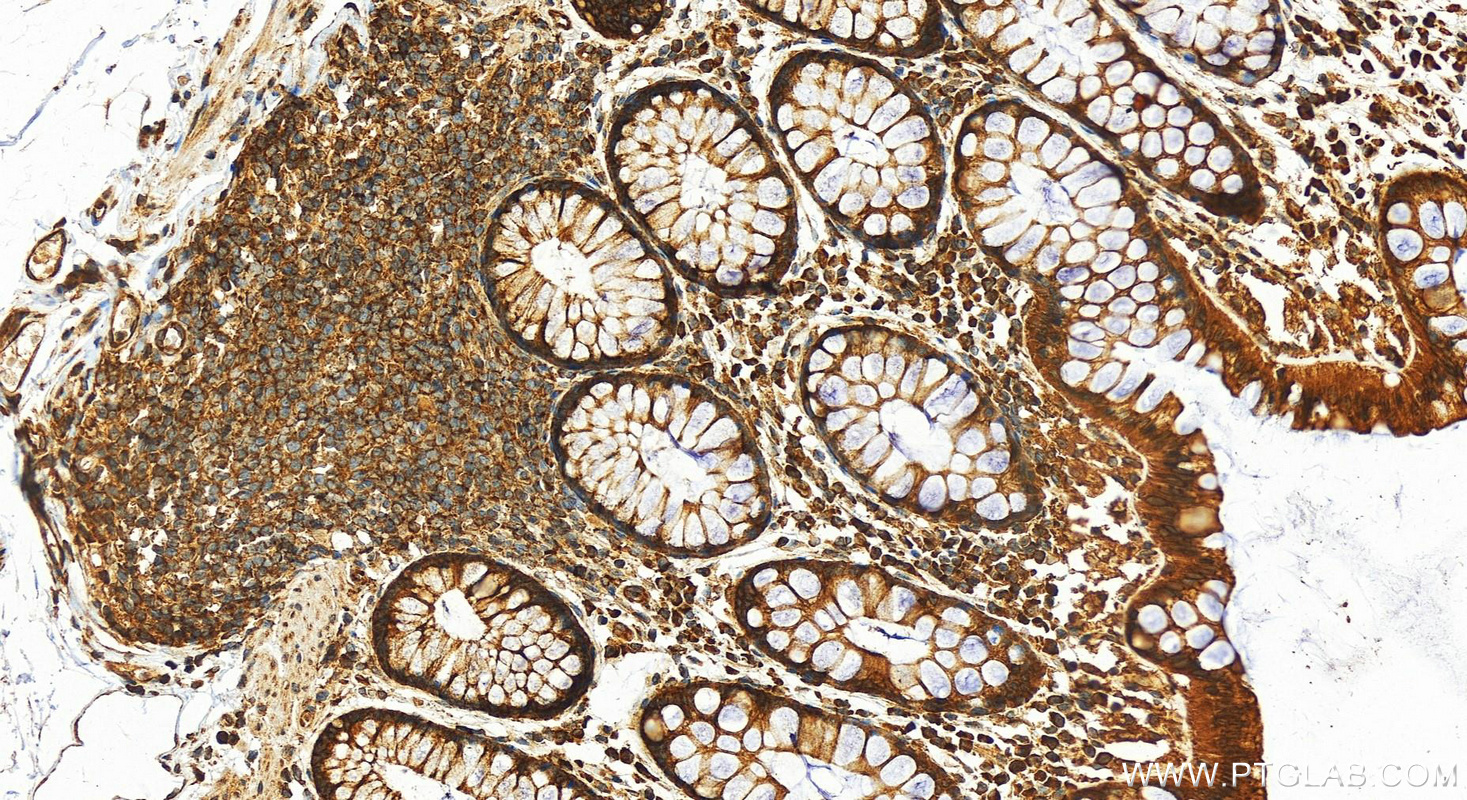 Immunohistochemistry (IHC) staining of human colon tissue using RPS3A Polyclonal antibody (14123-1-AP)