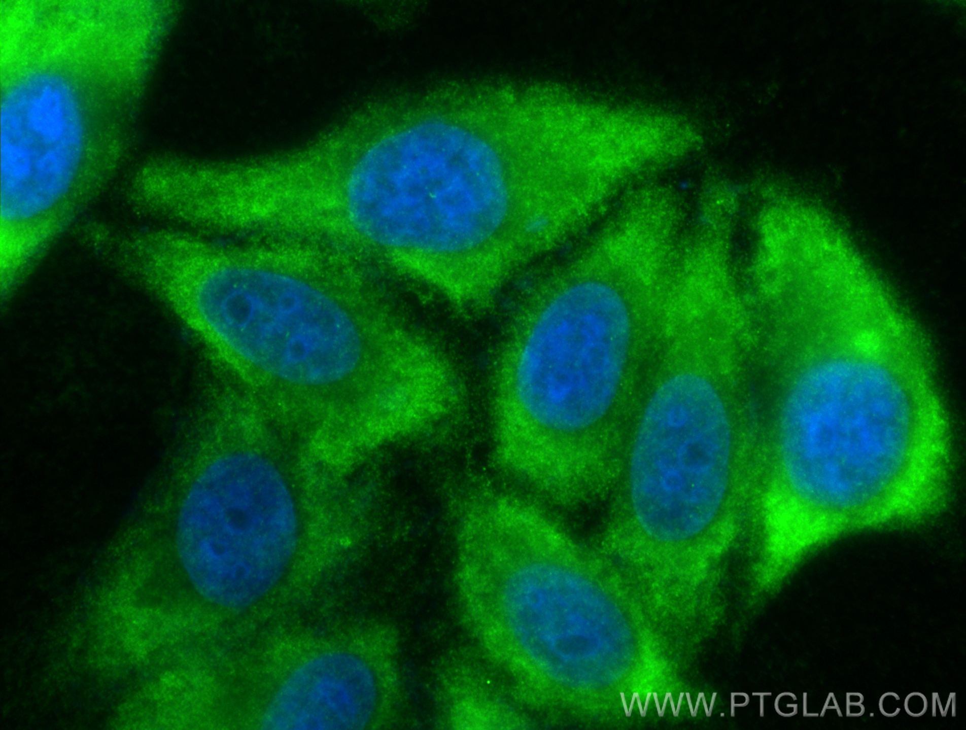 Immunofluorescence (IF) / fluorescent staining of HepG2 cells using RPS4Y1 Polyclonal antibody (17296-1-AP)